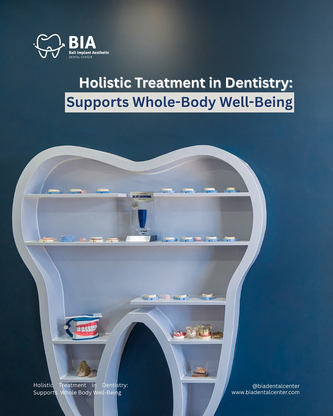 Content Instagram BIA Dental Center Bali