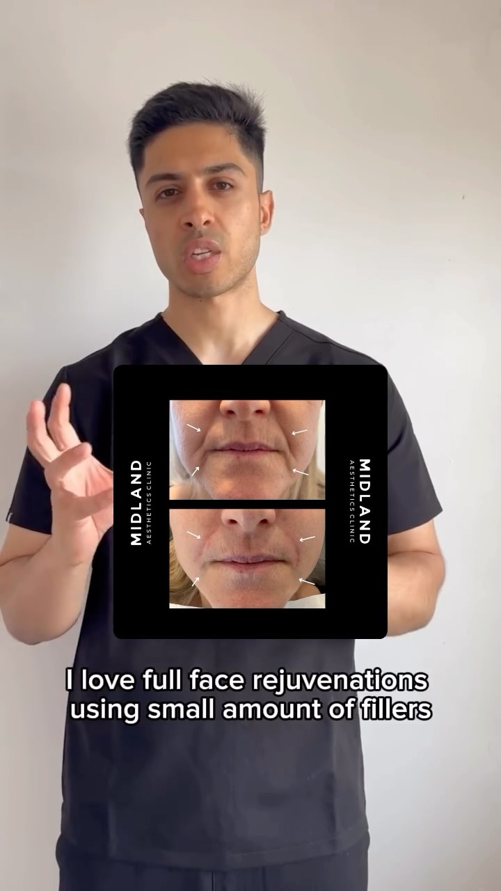 ✨ My Top 5 Treatments at the Moment ✨
1️⃣ PRP Everything!
PRP is having a major moment — and for good reason. It’s completely natural, regenerative, and powerful. Whether it’s PRP hair restoration, PRP for skin, or PRP for joints and tendons, the results speak for themselves.
2️⃣ Facial Rejuvenation
We love bringing back youthful structure with strategic dermal filler. Mid-face rejuvenation, softening lines and folds, restoring volume… it’s incredible watching someone look refreshed and feel confident again.
3️⃣ Under Eye Filler
Forever obsessed with the power of Redensity II. It beautifully masks eye bags, reduces darkness, and restores brightness to the under eye area. A small change that makes a big difference!
4️⃣ Anti-Wrinkle Treatment
A timeless classic. Smoother forehead lines, softened frown lines, lifted brows — it’s that effortless “fresh” look every time.
5️⃣ The Evergreens: Lips & Masseter Botox
Lips never go out of style — subtle or glam, we love them all.
And Masseter Botox is a game changer for teeth grinding, jaw tension, and slimming the lower face
𝖡𝗈𝗈𝗄𝗂𝗇𝗀𝗌
☏ 𝟢𝟩𝟦𝟫𝟪𝟫𝟪𝟩𝟣𝟪𝟪
☞︎ 𝗆𝗂𝖽𝗅𝖺𝗇𝖽𝖼𝗅𝗂𝗇𝗂𝖼𝗌@𝗀𝗆𝖺𝗂𝗅.𝖼𝗈𝗆
✩ 𝗐𝗐𝗐.𝗆𝗂𝖽𝗅𝖺𝗇𝖽𝖼𝗅𝗂𝗇𝗂𝖼.𝖼𝗈.𝗎𝗄
𝖬𝗂𝖽𝗅𝖺𝗇𝖽 𝖠𝖾𝗌𝗍𝗁𝖾𝗍𝗂𝖼𝗌 𝖢𝗅𝗂𝗇𝗂𝖼 𝖢𝗈𝗏𝖾𝗇𝗍𝗍𝗒
✩ 𝖬𝖾𝖽𝗂𝖼𝖺𝗅 𝖯𝗋𝖺𝖼𝗍𝗂𝗍𝗂𝗈𝗇𝖾𝗋 𝖫𝖾𝖽 𝖠𝖾𝗌𝗍𝗁𝖾𝗍𝗂𝖼𝗌
✩ 𝖥𝗎𝗅𝗅𝗒 𝖨𝗇𝗌𝗎𝗋𝖾𝖽 𝖢𝗈𝗌𝗆𝖾𝗍𝗂𝖼 𝖢𝗅𝗂𝗇𝗂𝖼
✩ 𝖯𝗋𝗂𝗏𝖺𝗍𝖾 𝖺𝗇𝖽 𝖢𝗈𝗇𝖿𝗂𝖽𝖾𝗇𝗍𝗂𝖺𝗅
#PRP #PRPTreatment #PRPHair #PRPSkin #FacialRejuvenation #DermalFillers #MidFaceRejuvenation #UnderEyeFiller #Redensity2 #TearTroughFiller #AntiWrinkle #Botox #ForeheadLines #FrownLines #BrowLift #LipEnhancement #LipFiller #MasseterBotox #JawTensionRelief #TeethGrinding #FacialAesthetics #NonSurgicalTreatments #SkinConfidence #AestheticClinic #BeautyTreatments