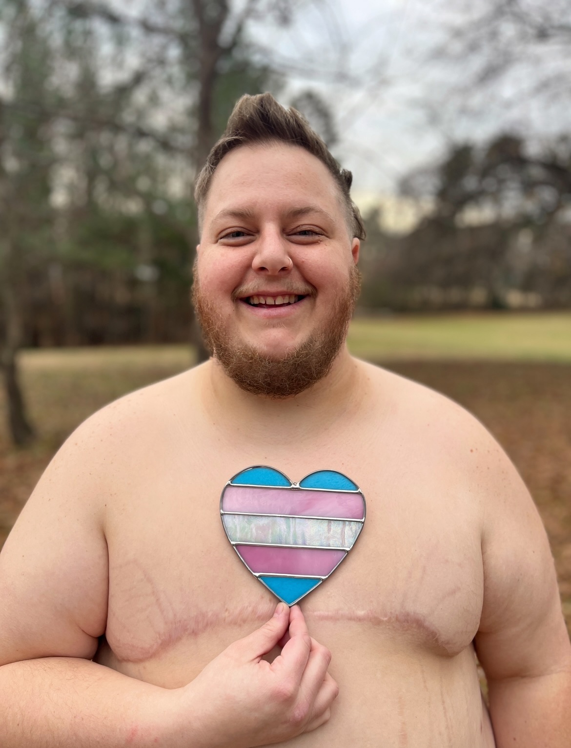 Celebrating a special anniversary today with @glass.creature - 3 years since his top surgery! 🏳️⚧️ He has beautiful results courtesy of @drsidhbhgallagher , but truthfully, the research and planning for this surgery took literal years and involved tons of headaches around insurance, bmi, and documents “proving” things about his gender. None of this was an issue with Dr. Gallagher (which is why we went all the way to Miami!) but I bring it up as a reminder of the difficulties trans folks have with receiving gender affirming care - and this was 3 years ago 🫠 So grateful for this literal weight off his chest and working every day for a future where all trans folks can receive the care they deserve! 🩷 PS swipe for more shirtless, nipless pics