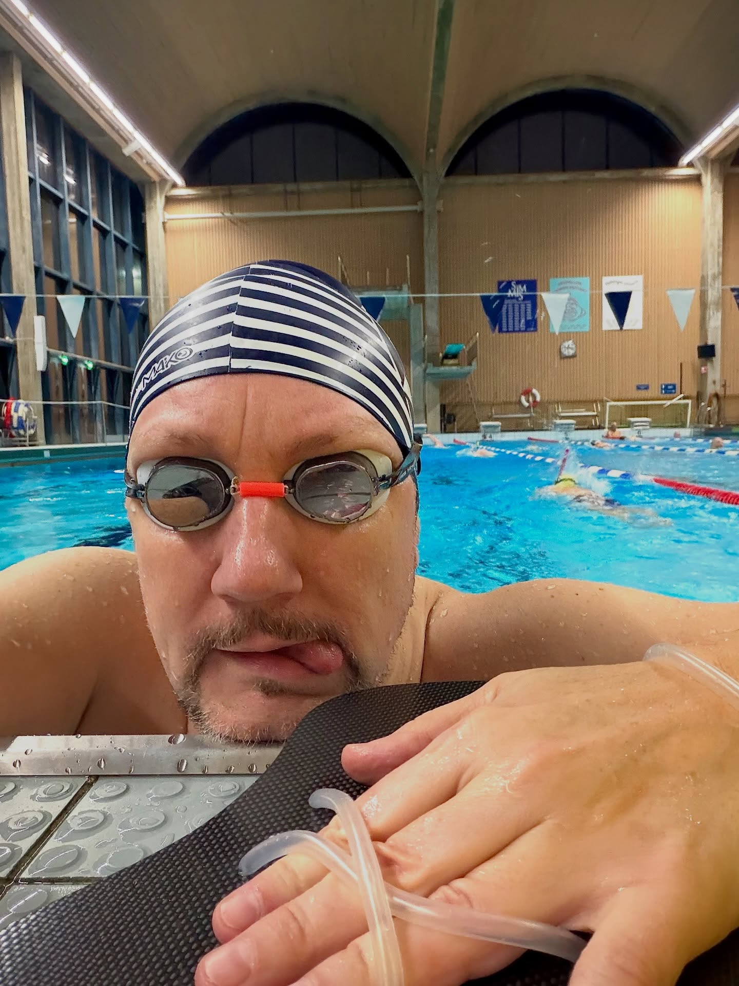 The day my body stopped recognizing itself, I stopped being myself.
I’ll never forget that phone call.
A few hours earlier, I had gone for a light jog.
Nothing special.
No pain.
No warning signs.
When I came back, I noticed a few bruises on my legs.
Then another one.
Then one on my lip.
That jog, without me knowing it, might have killed me.
And at the same time, it probably saved my life.
I went for a blood test.
Then my doctor called me back.
His tone had completely changed.
“Listen to me carefully. This is a matter of life or death. Go to the emergency room now. They are waiting for you.”
👇 Continue in the comments