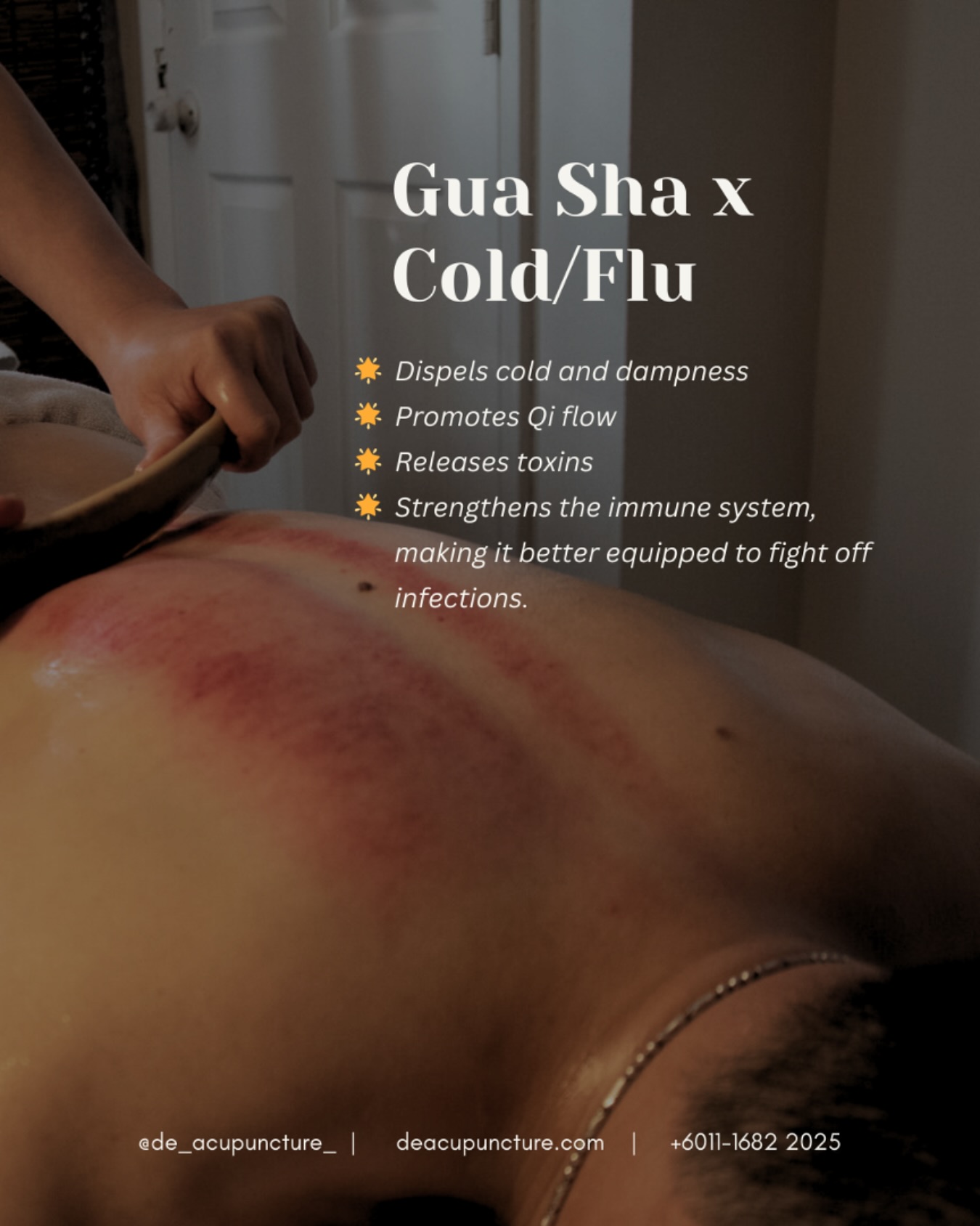 Gua Sha: Your Secret Weapon Against Colds and Flu
Feeling under the weather 🌧️? Gua Sha might be the natural remedy you need!
This ancient Chinese technique involves gently scraping the skin with a tool to promote blood flow and reduce inflammation.
When used to combat colds and flu, it can help:
✅ Soothe a Sore Throat:
By stimulating the neck and upper back.
✅ Relieve Congestion:
Ease congestion in the chest and sinuses.
✅ Boost Immunity:
Help your body fight off the virus faster.
✅ Reduce Muscle Aches:
Alleviate those pesky aches and pains.
So, the next time you feel a cold coming on, give Gua Sha a try😉!
_
#traditionalchinesemedicine #中医 #tcm #wellness #health #mindfulness #selfcare #malaysia #KL #PJ #de_acupuncture_ #医心医意中医坊
#DeAcupuncturexHerbsCentre
//
👩🏻⚕️医心医意中医坊
De Acupuncture x Herbs Centre
🇲🇾Certified TCM Practitioners
📣Appointment only, no walk-ins
📍Subang Jaya USJ 1 诊所
🈺Tue-Sat 9am-6pm
☎️WhatsApp 011-1682-2025
🌐deacupuncture.com