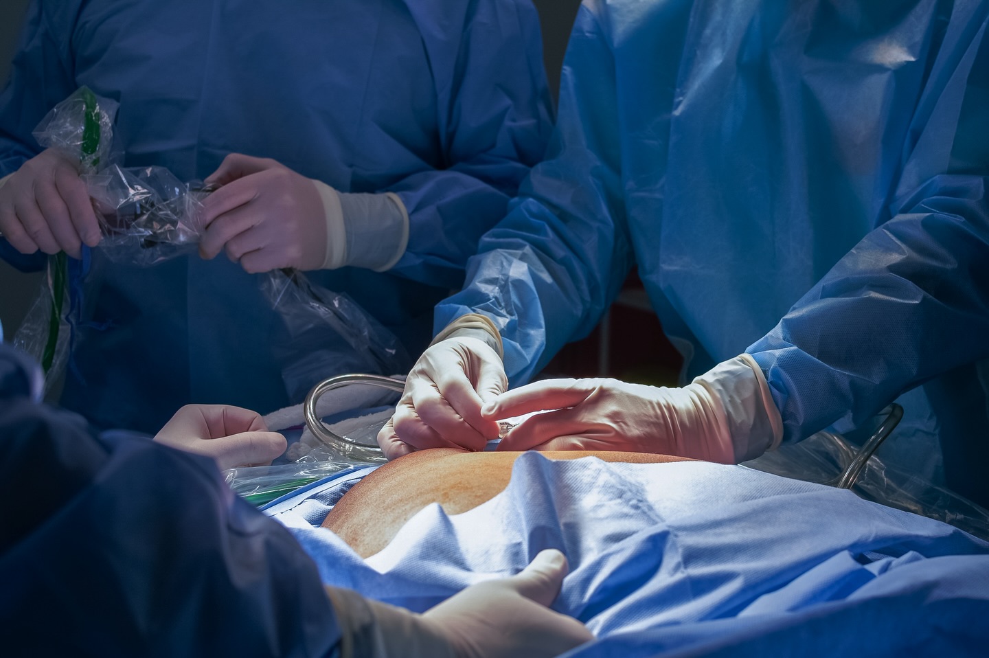 Tecnología de última generación, manos precisas y un equipo que trabaja con excelencia.
Cada cirugía bariátrica del Dr. Eduardo Bolaños es el resultado de años de experiencia, procesos seguros y un enfoque humano que prioriza el bienestar del paciente.
Transformar vidas es posible cuando la ciencia, la técnica y el corazón trabajan juntos. 💙✨
Cutting-edge technology, precise hands, and a team committed to excellence.
Every bariatric surgery performed by Dr. Eduardo Bolaños is backed by years of experience, advanced techniques, and a patient-centered approach focused on safety and long-term success.
Transforming lives becomes possible when science, skill, and heart work together. 💙✨
#health #healthy #healthandwellness #bariatric #bariatrica