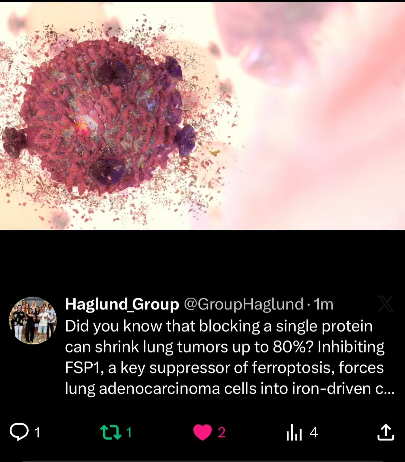 Did you know that blocking a single protein can shrink lung tumors up to 80%? Inhibiting FSP1, a key suppressor of ferroptosis, forces lung adenocarcinoma cells into iron-driven cell death, weakening tumors in mice. This breakthrough could open doors to new lung cancer therapies.
Reference:
www.sciencedaily.com/releases/2025/11/251120002606.htm