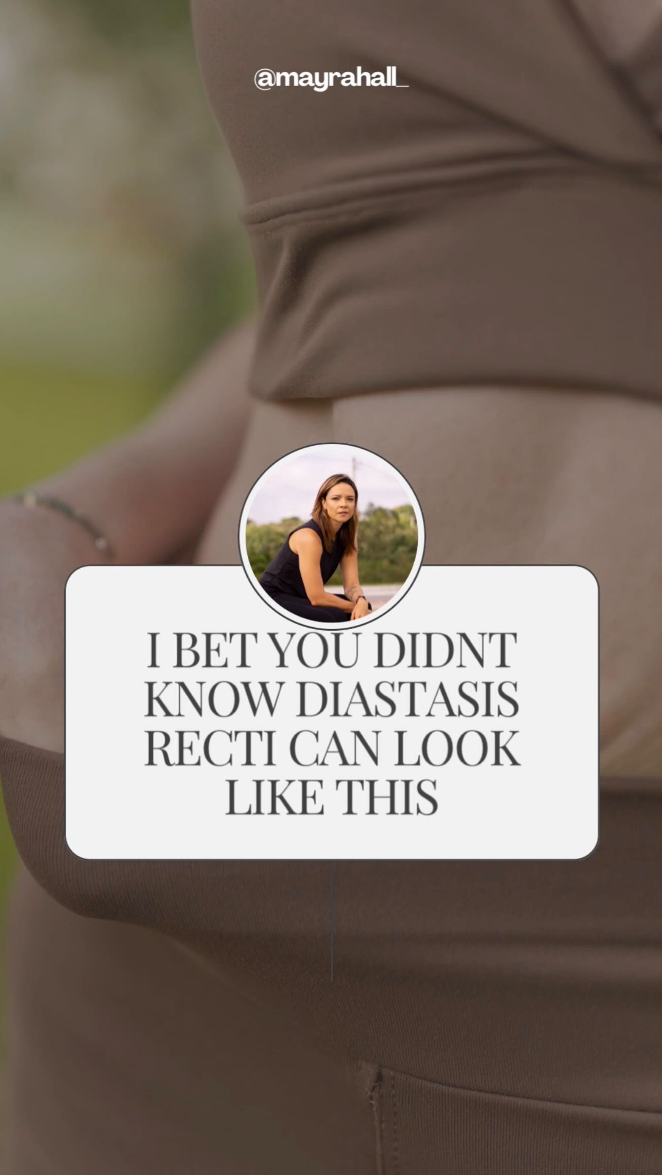 Diastasis recti doesn’t look the same for everyone—and that’s okay.
In these photos you’ll see some of the most common patterns I assess when working with clients, and why a one-size-fits-all approach doesn’t work.
It’s not just “a gap.” It can look like doming, coning, bulging, a soft midline… or nothing noticeable at all.
Diastasis recti is more than an aesthetic issue—it’s about pressure management, deep core function, and restoring your body’s support system.
If you want individualized support from a trainer who specializes in pre- and post-natal fitness, I’d love to guide you through your healing.
📩 Message me for coaching availability
#planomoms #prenatalfitness #pregnancyworkout #postnatalfitness #momstrong #fitmoms #womensfitness #diastasisrecovery