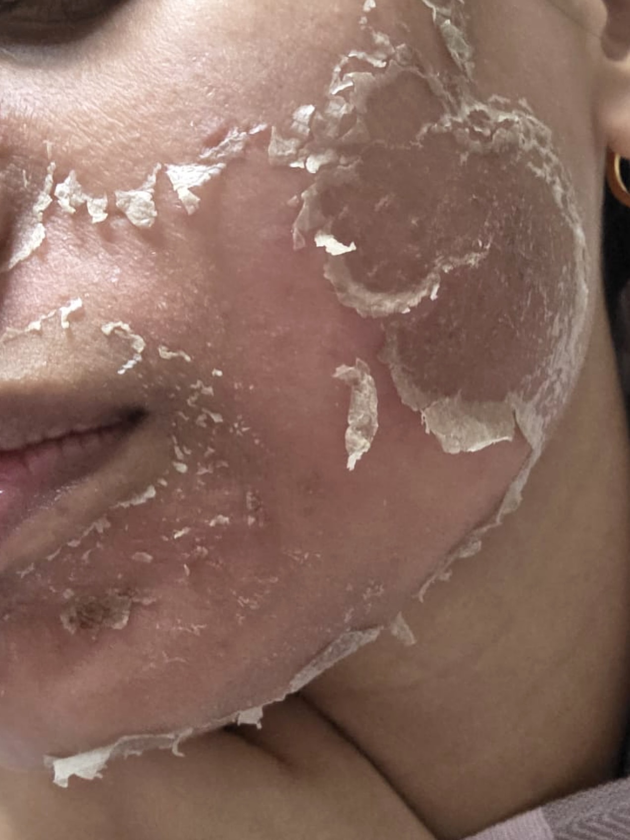 Transform dull, textured skin with our Algae Peel. This advanced herbal resurfacing treatment encourages deep cellular renewal, revealing clearer, firmer, more radiant skin—naturally.
#zeenaalgaepeel #canada #love #skincare #skincareroutineisamust #delta #tranformation #real #life #beauty #algaepeel #zeena #loveforpeels #peel #surrey #skin #hauteesthetics