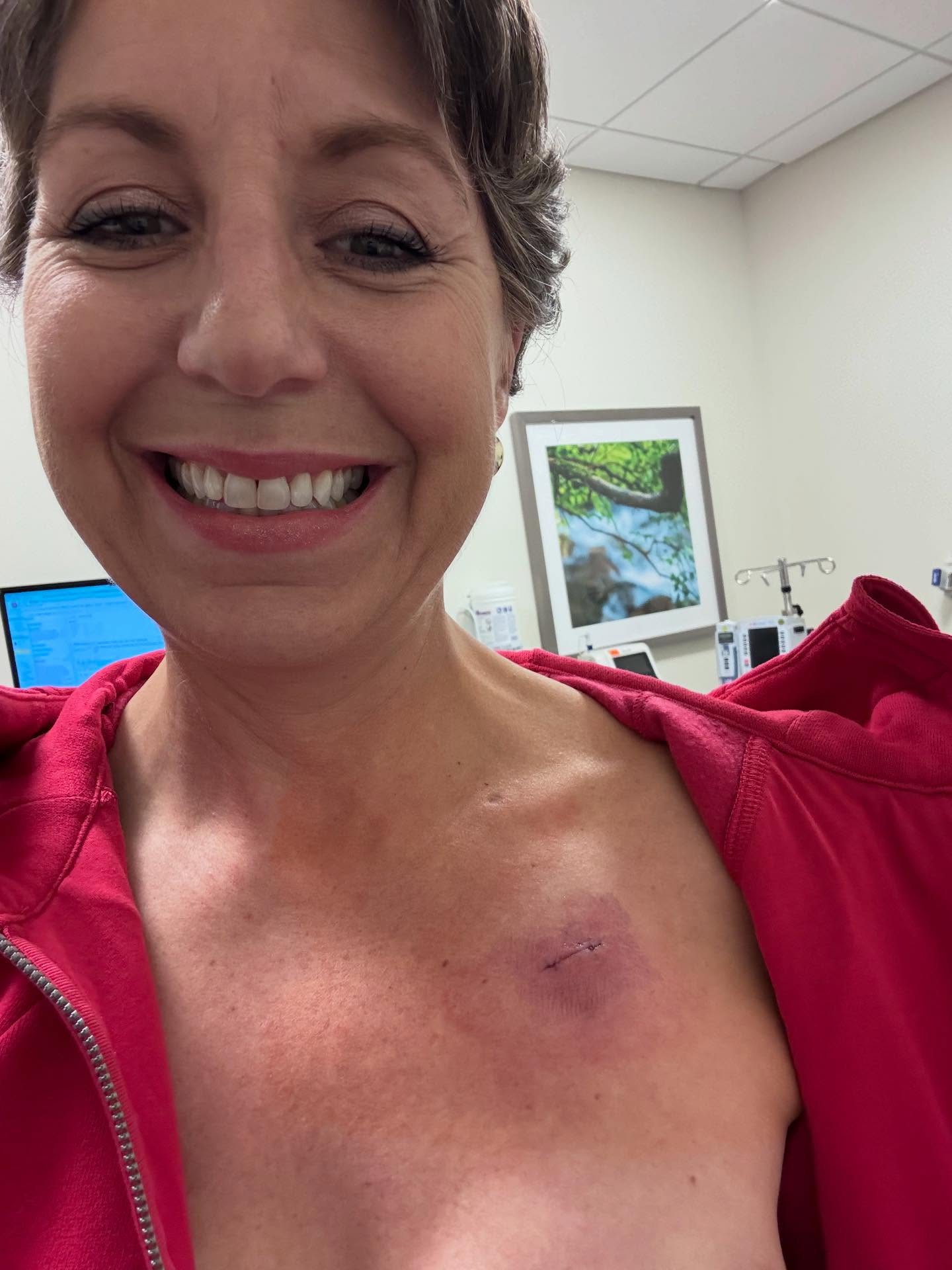 Port removal day! After 16 months of having this little device protrude from my chest, it was surprisingly unceremonious and quick to take out- a little numbing, a lot of tugging, some stitches and I walked out. That tiny port and 8” of tubing carried all the medicine that saved my life… and spared my veins.
But the moment it came out - what a relief! Afterwards I sat in the car doing the full cry-laugh-cry routine - mix of adrenaline relief and disbelief. Holy crap… this chapter is actually over!
And the best part: My baby was my chauffeur and caregiver today. She stepped up in the sweetest, calmest way for a big day with big feelings.
P.S. the nurse had a wicked sense of humor and played “I want to break free” by Queen to distract me during the procedure. 😂