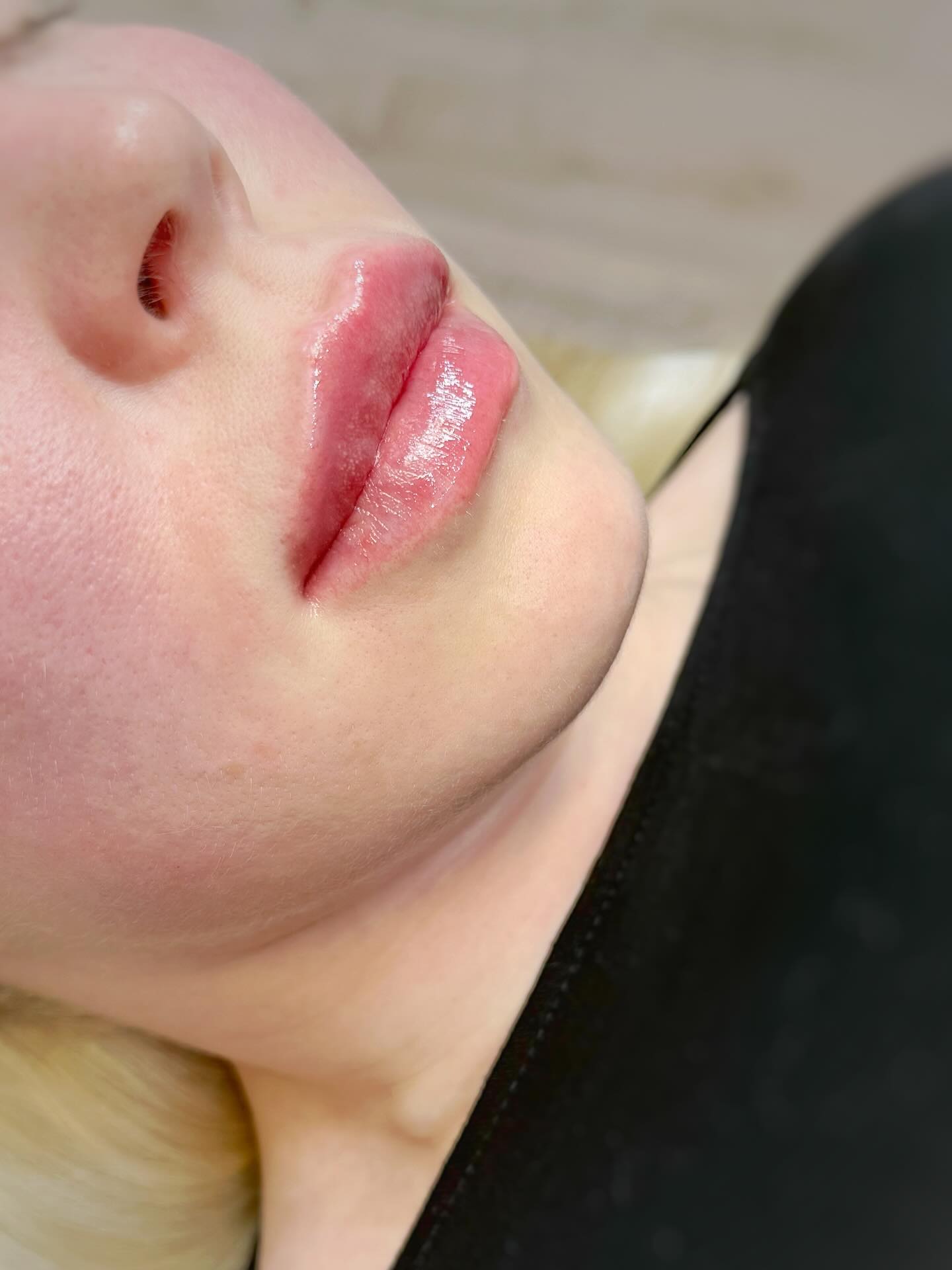 Muutama huulikuva viime päiviltä. Huulten muotoilu on yksi intohimo työssäni. Huulten ulkonäkö vaikuttaa paljon (!) kasvoilla. Ne tuovat naisellisuutta ja pehmentävät ilmettä.
Valikoimassani on useampi eri täyteaine hoitoa varten. Lisäksi valitsen tekniikan asiakkaan toiveiden mukaisesti.
Tullessasi hoitoon, sinun ei tarvitse tietää mitä aineita tai tekniikoita valitset. Kysyn ennen hoitoa toiveesi. 💋