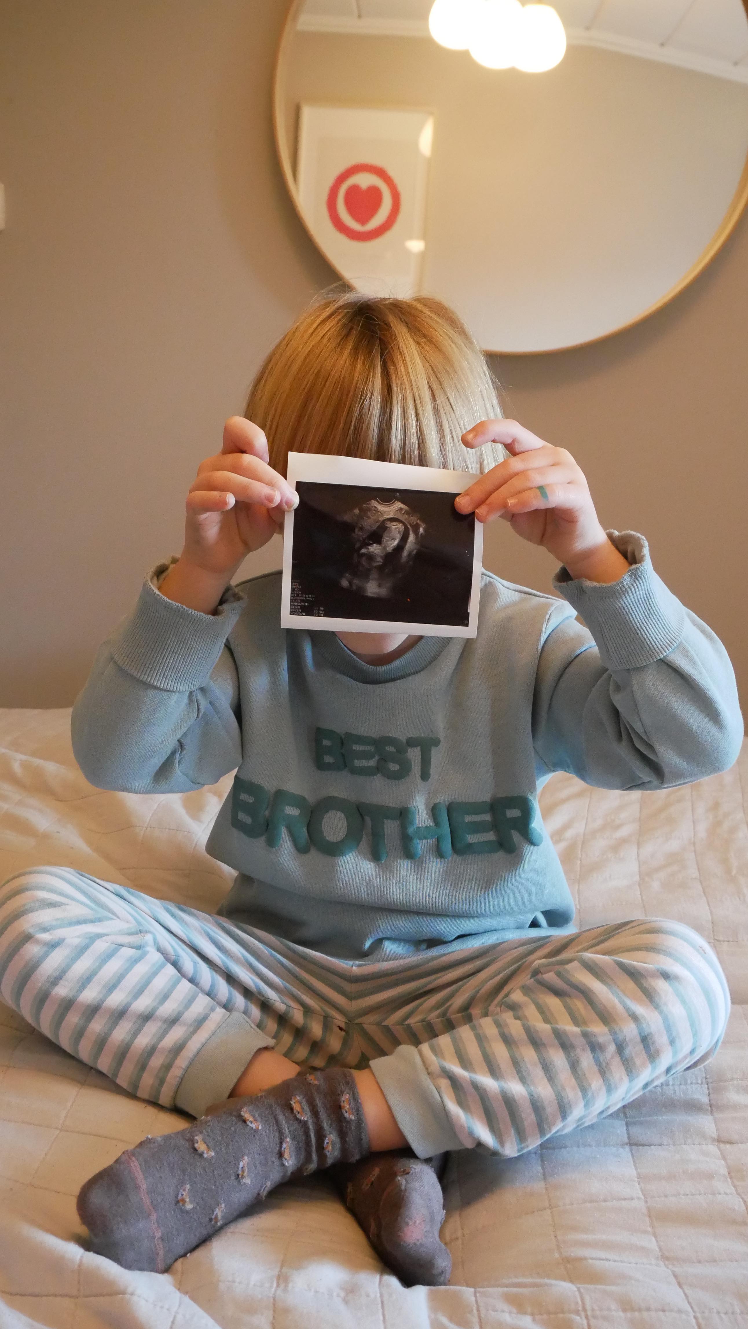 La nostra famiglia cresce: con noi c’è un nuovo cuoricino che batte🤎
Tra qualche mese Nordic baby n.2 sarà qui con noi 🥹
E non potremmo essere più felici di così. Leonard è al settimo cielo, e noi con lui.
Mamma, pappa e il tuo fratellino non vedono l’ora di stringerti tra le braccia, bebis🤍
(Ps: “pappa” e “bebis” in svedese significano “papà” e “neonato/bebè”🥰)
#babyn2iscoming