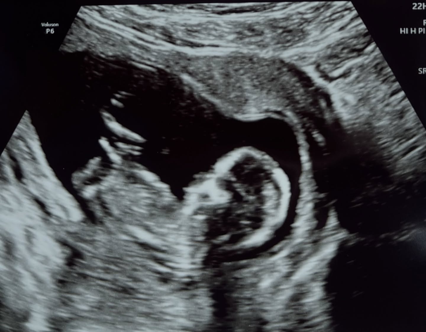 I’ve been a little quieter on here these past few months… turns out I’ve been growing a tiny miracle 💕
We’re so excited to be welcoming our baby girl in June next year 🙏🏼
I’m still seeing my beautiful 1:1 clients as usual, and will share more about my plans for the rest of the year soon. For now, just soaking in this new chapter and listening to my body as it grows our little love 💕