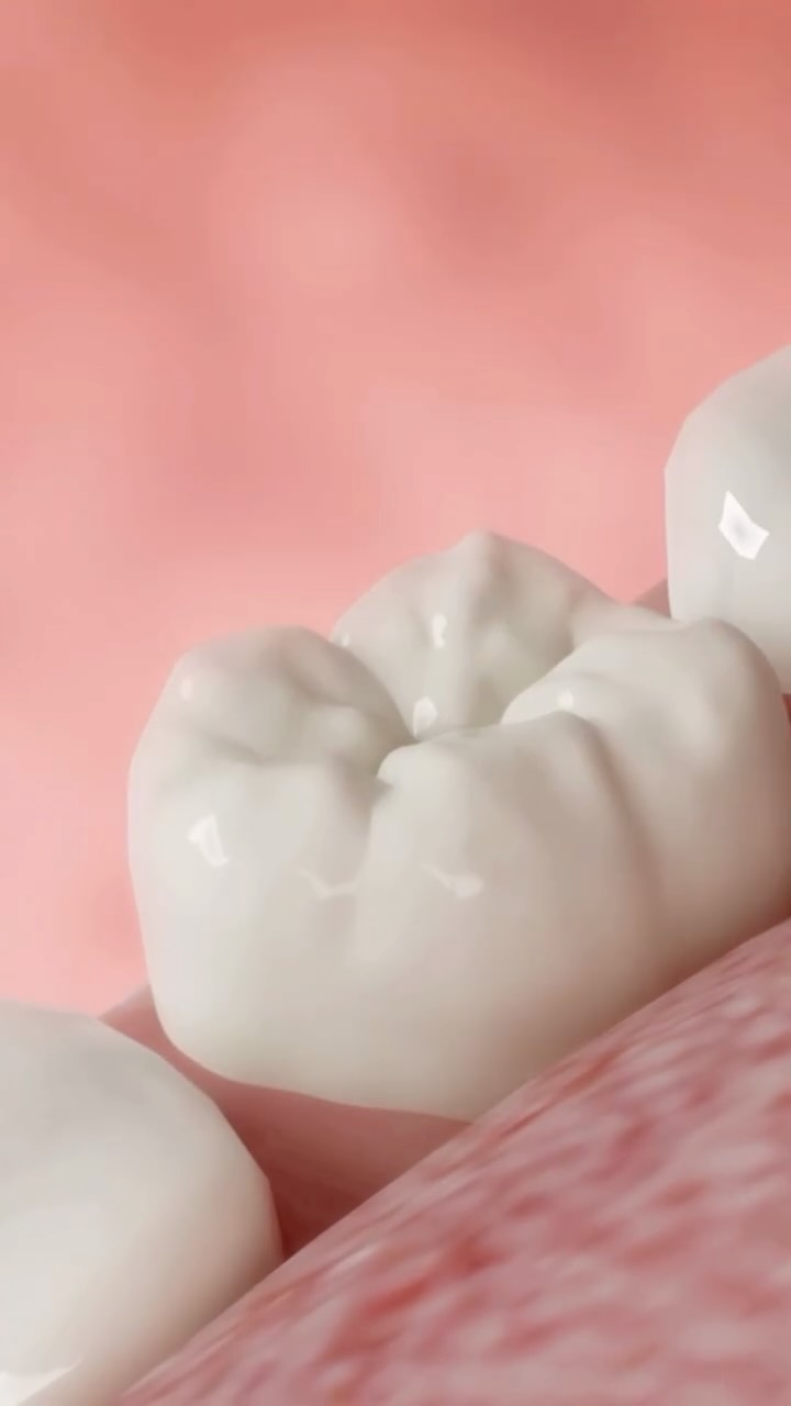 🦷⚡ MITOS SOBRE LOS IMPLANTES DENTALES QUE SEGURO HAS ESCUCHADO
…y que hoy vamos a desmontar 😉👇
❌ “Duelen muchísimo”
La mayoría de pacientes dicen lo contrario: no sintieron dolor durante la colocación.
❌ “Si soy mayor, no puedo ponerme uno”
La edad NO es el problema. Lo importante es el estado del hueso y las encías.
❌ “Los implantes se caen con el tiempo”
Con buena higiene y revisiones, pueden durar décadas.
❌ “Es un proceso largo y complicado”
Con planificación digital, muchos casos son rápidos, seguros y predecibles.
💬 Dime: ¿cuál de estos mitos habías creído tú?
Te leo 👇
#ImplantesDentales #MitosDentales #ClínicaTresserra #OdontologíaAvanzada #dentistabarcelona #clínicadental