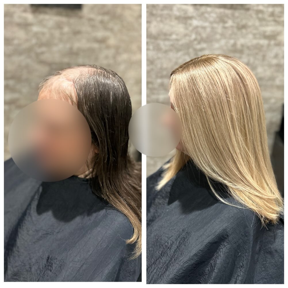 This incredible woman has been one of my ladies for years now, I’ve been reflecting on how much of a relationship we can build over the years and it’s such a privilege and pleasure. She is one of the most resilient and strong women I know. Today we changed it up a bit and we are both thrilled with the results. .
.
.
.
.
#lacetopwigs #lacefrontwigs #lacewigs #wigs #lacefrontal #alopecia #areata #hairloss #hairreplacements #bespokewigs #customcolouredwigs #handmadewigs #wigbuilding #hairintegration #laceintegration #hairextensions #weave #hairlossspecialist #trichologist #trichology #hairlosssolution #hairlosssalon #hair