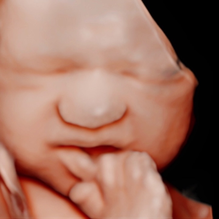 😍😅 30 weeks
#pregnancy #ultrasound #pregnant