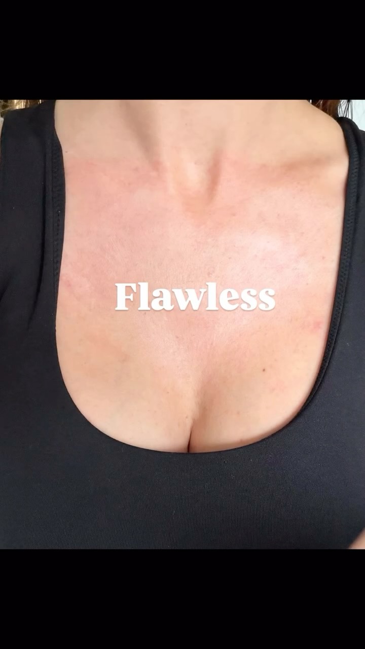 Enlighten Peel ✨
Since photoaging is one of the leading causes of wrinkle formation, make sure you wear sunscreen daily with a strength of at least SPF 30.
Protecting your skin from the sun keeps it looking healthier and prevents other types of damage like skin discoloration. Apply sunscreen generously and reapply often, especially if you’re sweating or swimming🏊
Treatments for aging décolletage range from daily skincare and sun protection to professional procedures like Laser Therapy, Chemical Peels, and Microneedling.
🔆Treatment:
@revepeel_reveskin pre&post homecare and 1 Enlighten Peel🔥
#decollete#melasma#sundamage#photodamagedskin#ᴄʜᴇᴍɪᴄᴀʟᴘᴇᴇʟ#reveskin#enlightenpeel