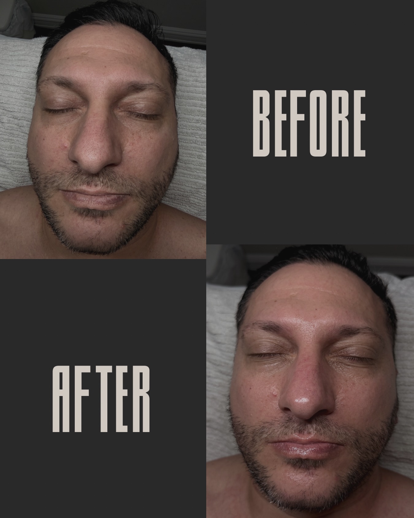 Property work all weekend! Someone was in dire need of some self-care 🤯 This is the result of a super rejuvenating 1.5 hour custom facial!