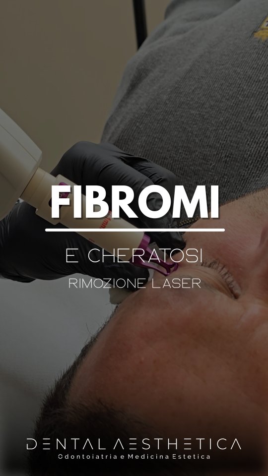 Anche tu detesti quelle macchie scure e quelle escrescenze sul tuo viso quando ti guardi allo specchio?
Macchie, cheratosi e fibromi possono essere davvero anti estetici, lo sappiamo.
Ma non sei costrett* a conviverci per sempre. Adesso puoi eliminarli con trattamenti laser non invasivi e praticamente indolore.
Dental Aeathetica
✨️ Odontoiatria e Medicina Estetica
📍 viale della Grande Muraglia 256
📱 375 88 47 069