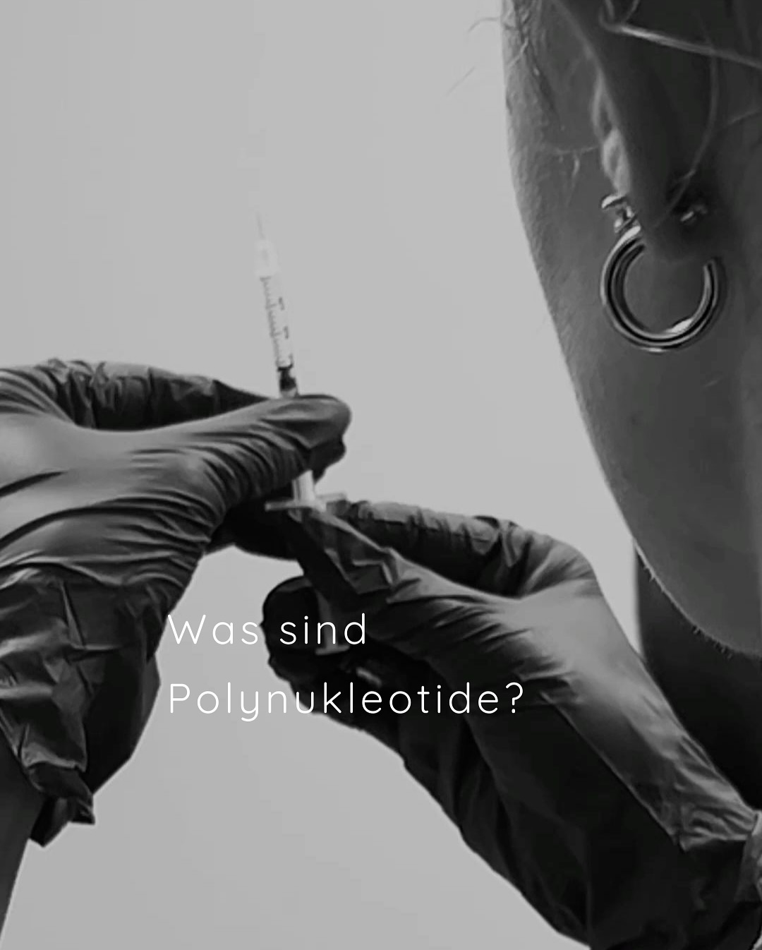 Polynukleotide sind natürliche Moleküle, die aus langen Ketten von Nukleotiden bestehen - den Bausteinen unserer DNA. 🧬 Für kosmetische Anwendungen stammen diese Nukleotiden meist aus gereinigter Fisch-DNA, um höchste Verträglichkeit zu gewährleisten.
Polynukleotide boosten Kollagen, Elastin und Feuchtigkeit tiefenwirksam.
Bei Fragen zur Behandlung sind wie gerne da. 🥼
#polynukleotide #polynukleotidezürich #aestheticmedicine💉 #nuaaesthetics