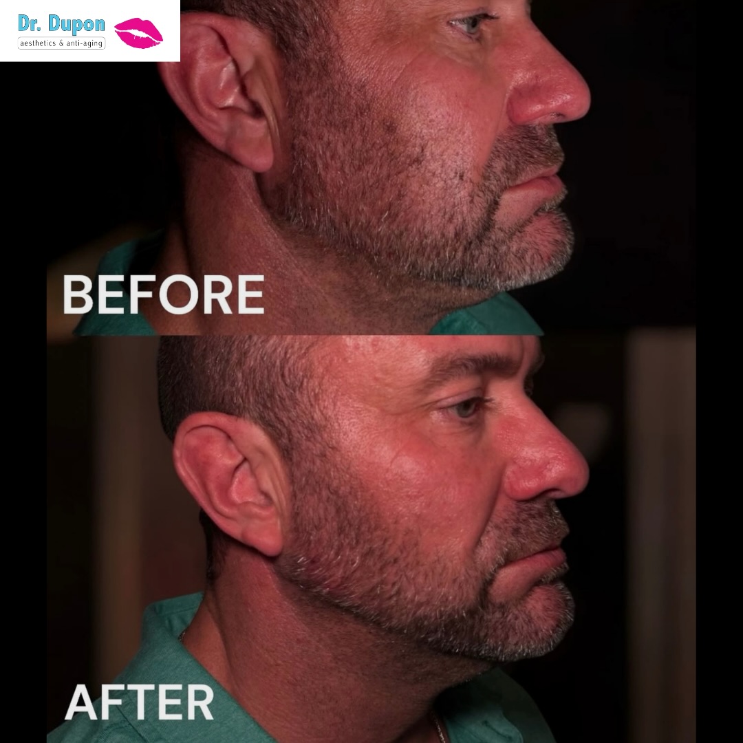 Men contour too. 😍 Sharpen your jawline and boost your confidence! Call or DM for more information! 🎄