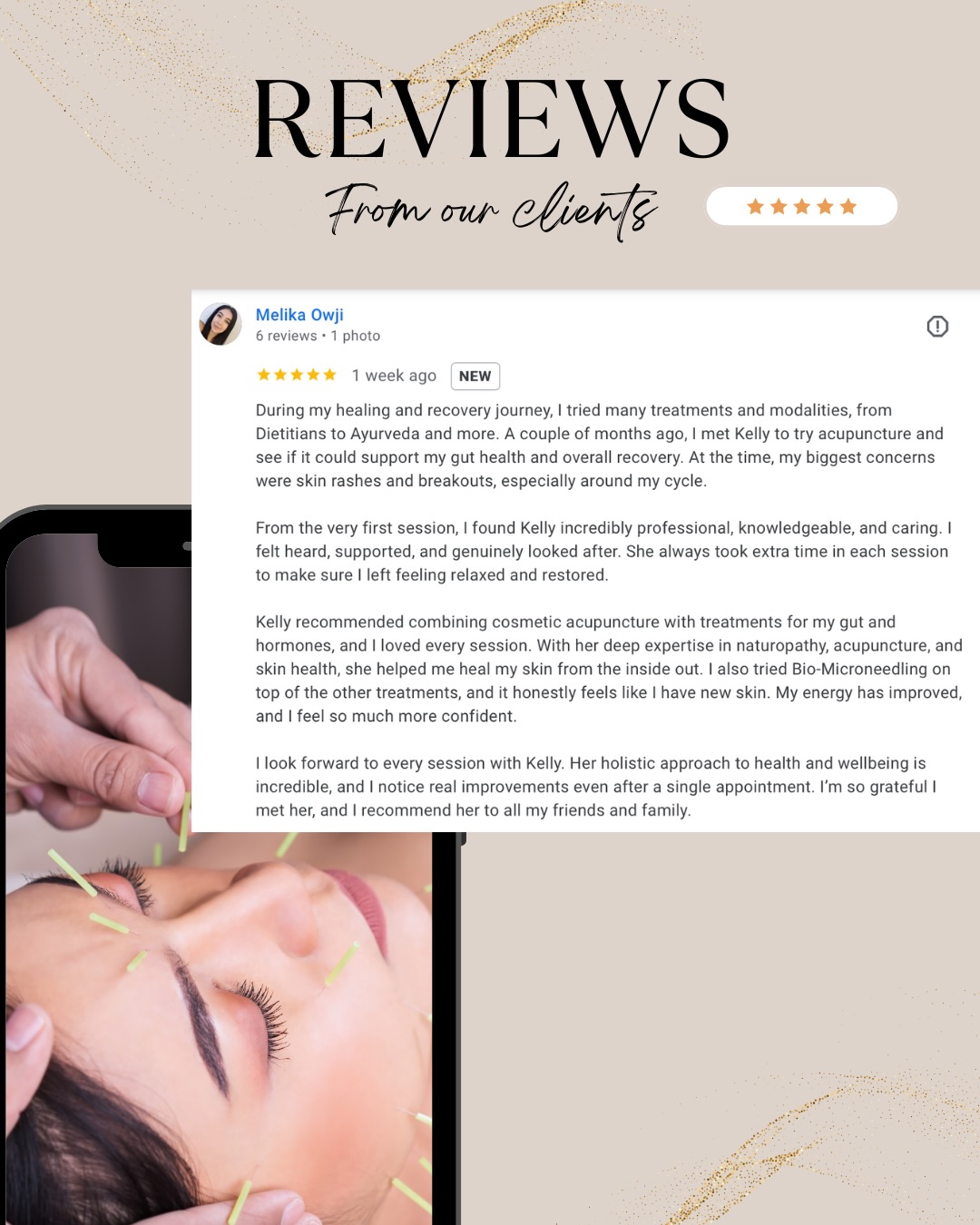 It’s that time of year where I pause and reflect on all the beautiful humans I’ve had the privilege to work with 🧡
This year we’ve treated a lot of acne, gut health issues, hormone imbalances and stress. The most rewarding part is seeing clients come out the other side not only with calmer, clearer skin…but feeling healthier, more balanced and more themselves than ever.
I’ll be sharing some of the lovely words my clients have shared over the next few weeks. I hope they give you a little spark of hope and inspire you to smash your skin + health goals in 2026 ✨
Whether that looks like booking in for acupuncture, acu-facial, lymphatic bodywork, bio-microneedling or naturopathy, I’m here to support you every step of the way 🫶
#acneclinic #acnespecialist #holisticskin #gutinflammation #hormonehealth