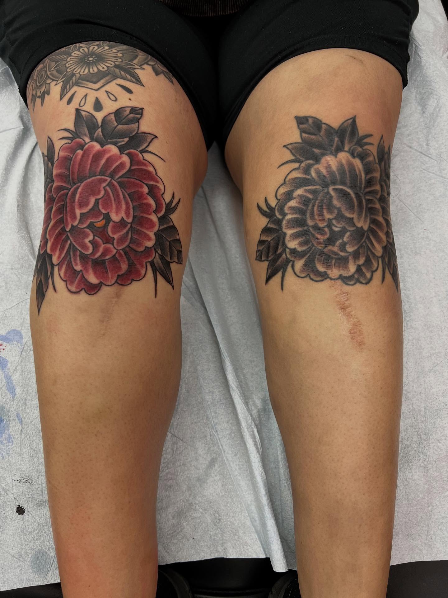 Double scar cover up with these super cool peonies #tattoo #flowertattoos #scarcoverup