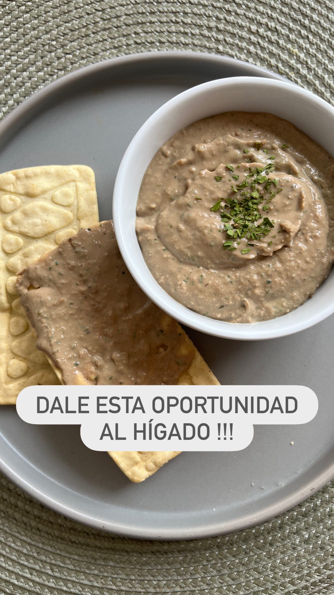 👌🏼Una receta para cualquier edad! Por su textura y sabor amigable!
Paté de hígado de pollo cremoso
📌Ingredientes:
* 400 g hígados de pollo limpios
* 120 g mantequilla sin sal
* 1 cebolla pequeña
* 2 dientes de ajo picados
* 60 ml vino blanco o jerez
* 60 ml crema de leche o leche vegetal
* 3 hojas de laurel
* ¼ cdta nuez moscada
* Pimentón español
* Sal y pimienta negra
📌Preparación
1. Reposar loos higado en leche vegetal o de vaca 20 minutos
2. Sofreír cebolla en 30 g de mantequilla, añadir ajo.
3. Agregar hígados, laurel y tomillo y especias que desees
4. Dorar hasta que estén bien cocidos. (Aproximadamente 10 min fuego medio)
5. Añadir el vino, dejar reducir y retirar laurel
6. Licuar el sofrito de los hígados con crema, perejil, sal, pimienta y nuez moscada hasta que quede bien cremoso.
7. Envasar en un frasco y llevarlo a la refrigeradora para que se espese.
Listo para untar y disfrutar 😍
‼️Recuerda que este paté no solo es para untar! Puedes utilizarlo en tus sopas, salsas, etc.