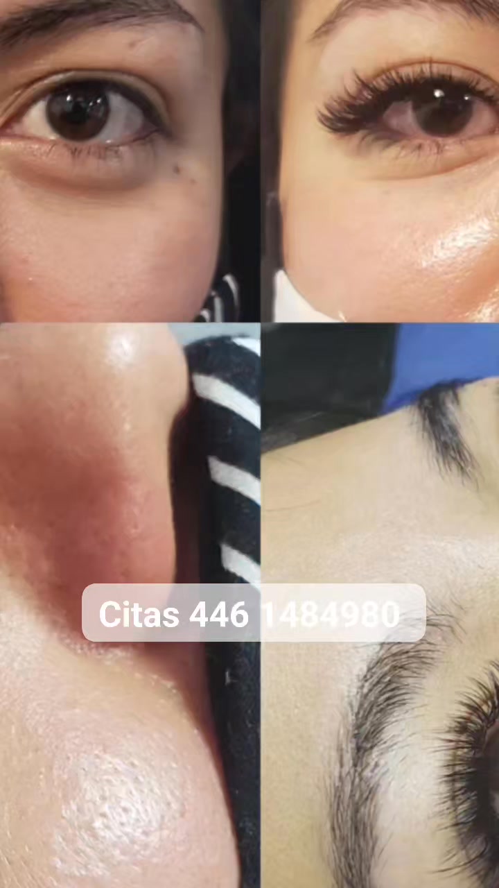 La diferencia entre “te ves bien” y “WOW, ¿qué te hiciste?” está en tus pestañas 👀✨
Pruébalas 1x1 y entiende por qué todas regresan a retoque.
📲 Mayores informes o reserva al 4461484980
#ExtensionesDePestañas #DinuxSPA #RetoquePestañas #MiradaWOW