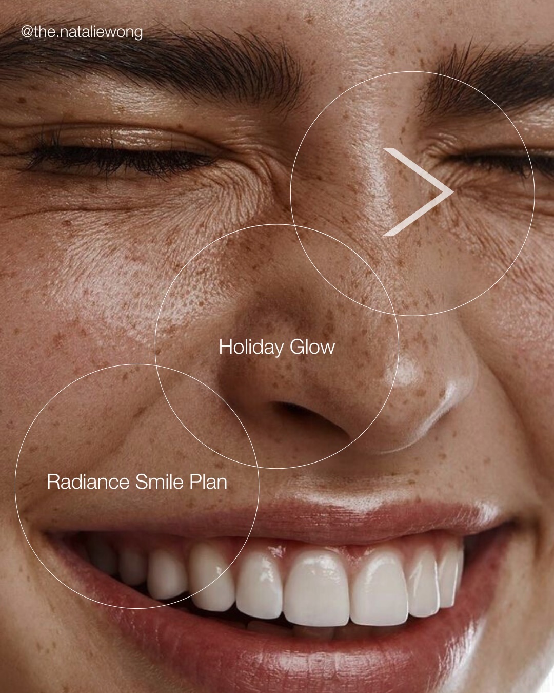 ✨ The Radiance Smile Plan ✨
Celebrate the festive season with 20% off:
• Hygiene Session
• In-Office Whitening
• At-Home Whitening
Transform your smile just in time for the holidays. 🤍
DM to reserve your slot.