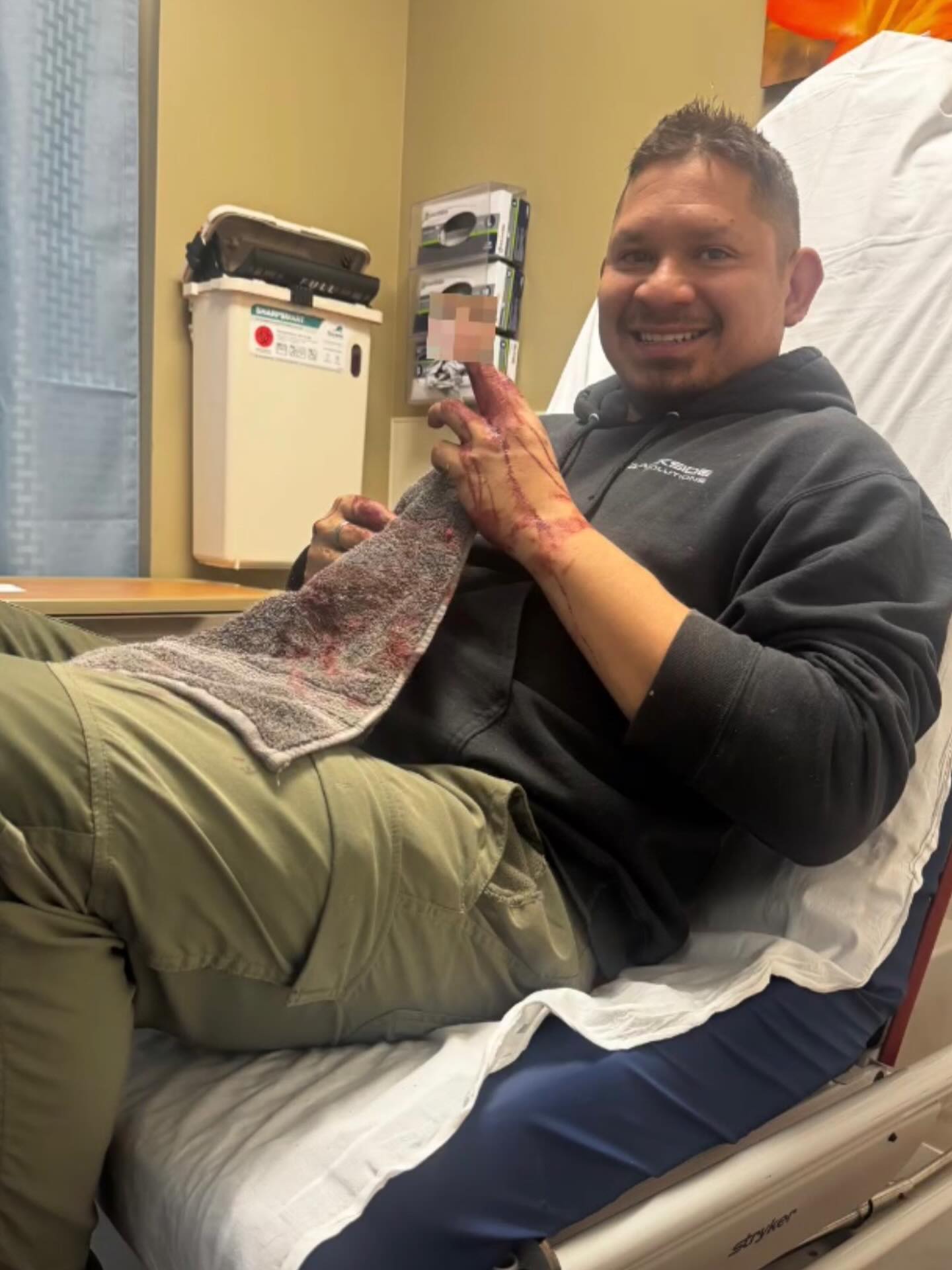 A note from: A Cut Above (the knuckle)! 🪚🩸
Sunday evening I had a pretty severe finger vs. table saw accident and unfortunately this means a short slowdown in project completion while we navigate. Tomorrow, we meet with a hand surgeon and we’ll go from there.
In the meantime, we want to be as upfront and transparent as possible with our customers — timelines will shift as we work through recovery.
Quality matters to us more than rushing, so we’ll reach out individually with updated timelines.
Thank you for the patience, kind words, and continued support while we get pieced together and back to full speed! #customwoodworking #customwoodwork #customwoodart #tablesaw #fingerinjury #trauma#middlefinger #smallbusiness #accidentshappen #fypage