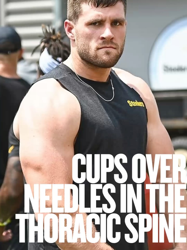 Some big stirring news in sports medicine over the weekend with dry needling in the NFL on TJ Watt and safety concerns of using needles in the thoracic spine. This is an area where cups can do so much good and have such a lower risk for puncturing lung tissues in the region.
⭕️
Now don’t misinterpret what I am saying here… as a Physio in Colorado, I could dry needle and it is a great modality, but here in California, for now, physical therapists are not allowed. What’s awesome though is not being able to needle hasn’t really changed my outcomes much at all because cups are super helpful in the thoracic spine. With the #mfdprecisionpump and using accurate pressures, we can achieve depths all the way to the bone if necessary, but without the risk of a more invasive tool like a needle.
⭕️
So choose what is right for your practice. We don’t always have to be so aggressive, and often less is more. If you can use needles in your discipline, why not choose a cup instead of a needle over sensitivity areas? Comment below 🤓: