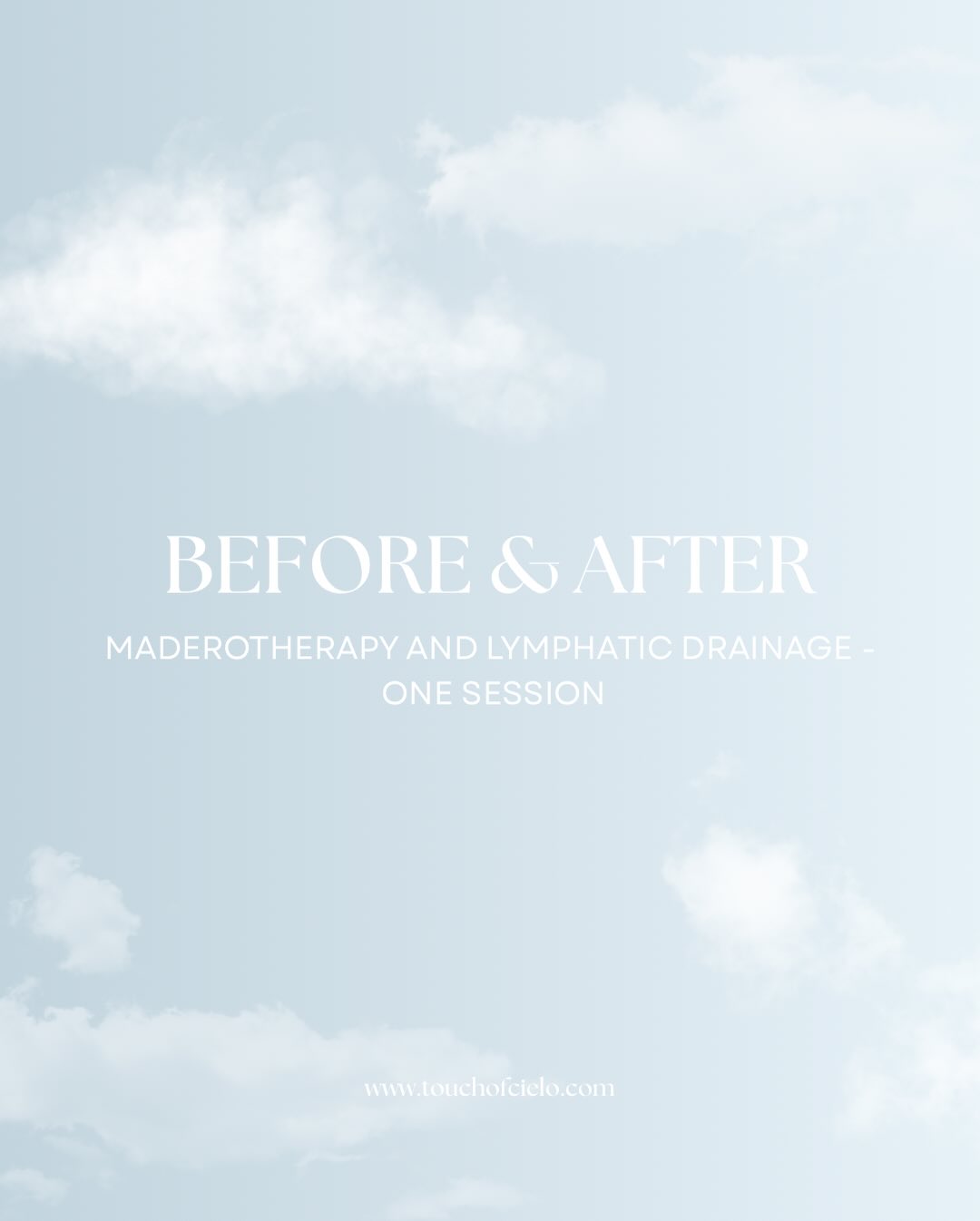 Before and after a combined maderotherapy and lymphatic drainage session.
Sculpting, reduced retention, and a lighter feel, all in one treatment.
The more you do it, the more results you will see.
Visit our website to book yours
Always with care,
Touch of Cielo🩵
www.touchofcielo.com
#lymphaticdraingeresults #maderotherapyathome #massagetherapistnearme