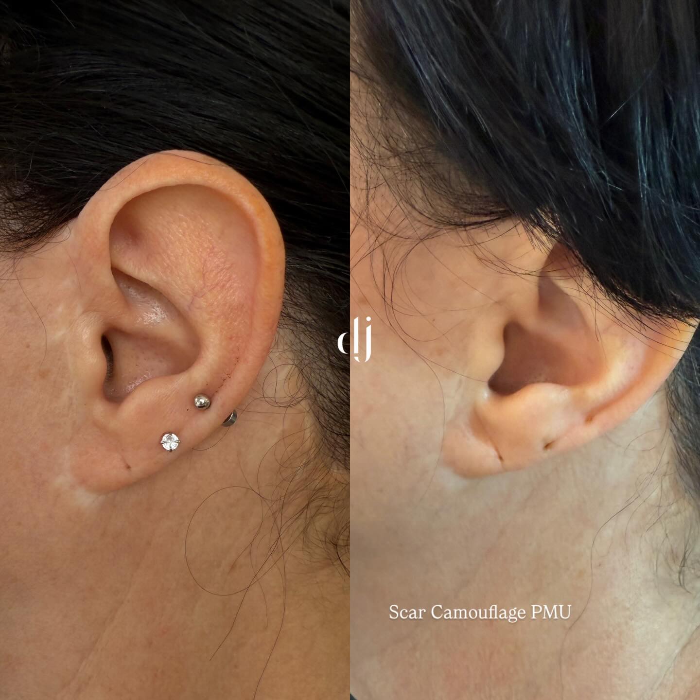 We specialise in Medical PMU
Consultations are always recommended first in clinic to assess the area.
Book in bio
#pmu #scarcamouflage #inklessstretchmarksremoval #medicaltattoo #inklesstattoo