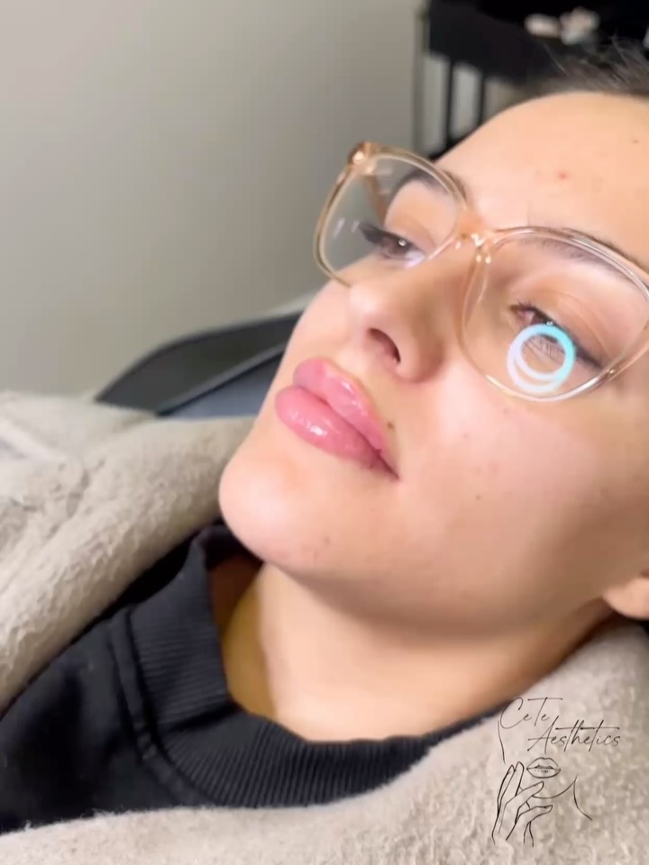 Festive Lip Enhancement Offers 🎄✨
Secure an exclusive seasonal saving when you book now. Your discounted treatment can be scheduled for any future date 🤍
Schedule your appointment online ⬇️
www.ceteaesthetics.co.uk
#lipfiller #scunthorpebusiness #medicalaesthetician