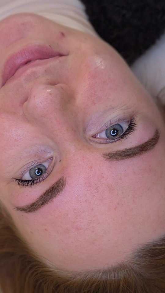 - SOURCILS POUDRÉS -
Avant | Après cicatrisation, 1 mois apres la création
Après | Après retouche fixatrice
Comme vous pouvez le constater, ici les sourcils sont cicatrisés et se sont donc éclaircis. On obtient donc un résultat poudré tres doux et aéré. Ma cliente souhaitait donc intensifier à la retouche, j ai donc pris une teinte un peu plus soutenu pour qu à la cicatrisation la pigmentation soit un peu plus foncée 🤎 Pour vous prouver qu il ne faut pas peur si vos sourcils sont trop foncés le jour J, vous perdez 40 à 50 % d'intensité, la preuve en vidéo 😜
📍 Homblières (02720) — salon privé, sur RDV uniquement
🗓️ Ouvert du lundi au samedi matin (non-stop le midi)
❓️💸https://taplink.cc/regardpoudre
📲 📞 06 49 57 28 05
#Dermopigmentation #maquillagepermanent #maquillagesemipermanent #sourcilsooudrés #homblieres #aisne #hautsdefrance