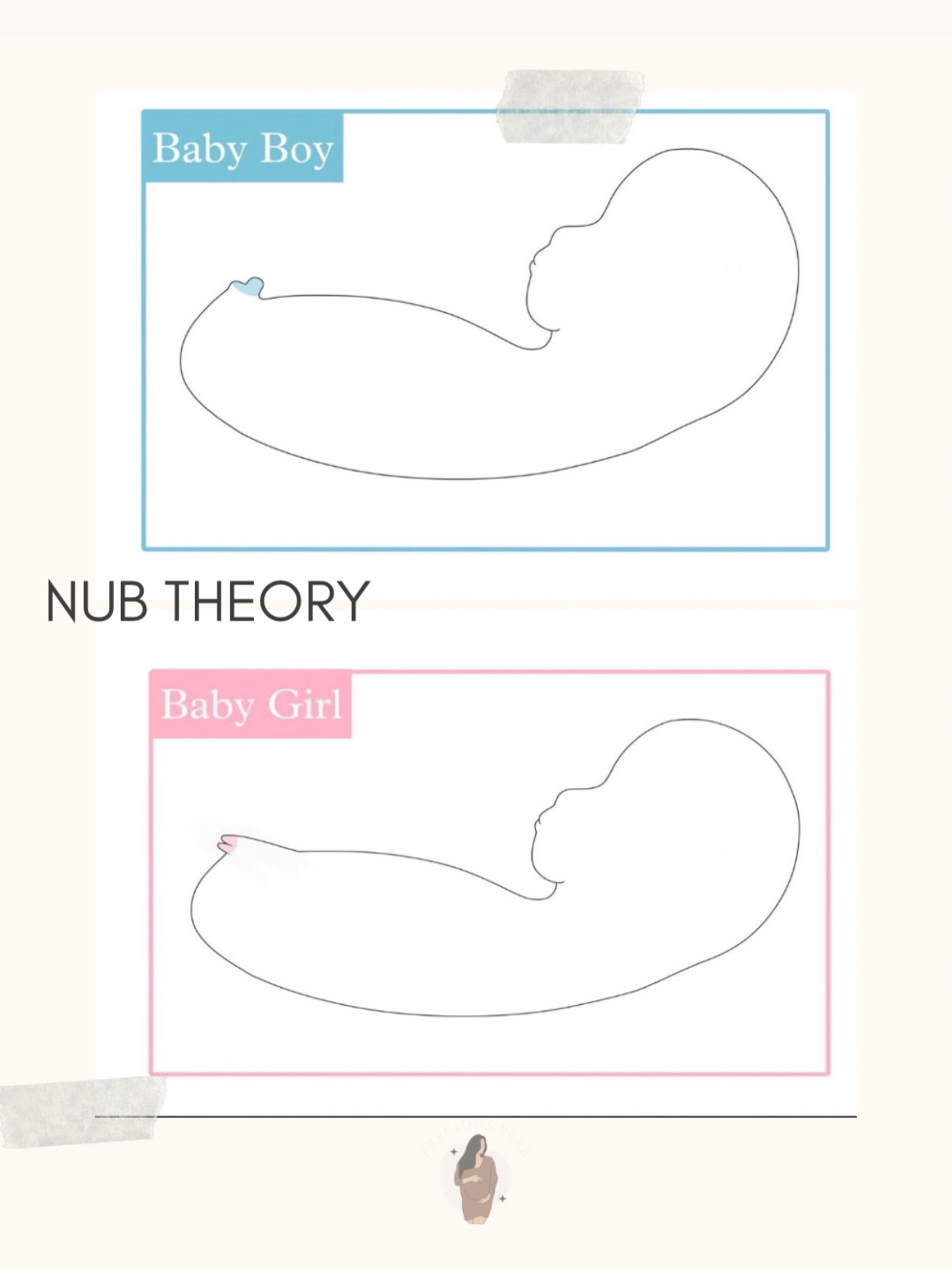 Nub Theory is a popular early gender prediction method based on what we see on ultrasound around 12 weeks.
If the baby’s little “nub” is angled upward, it usually suggests boy.
If it’s flat or straight, it usually suggests girl.
It’s not 100%, but when someone trained looks at the images at the right timing, it can be very accurate; up to 98–99%.
Fun, early guess..not a guarantee. 💕✨
#nubtheory #pregnancy #1sttrimester