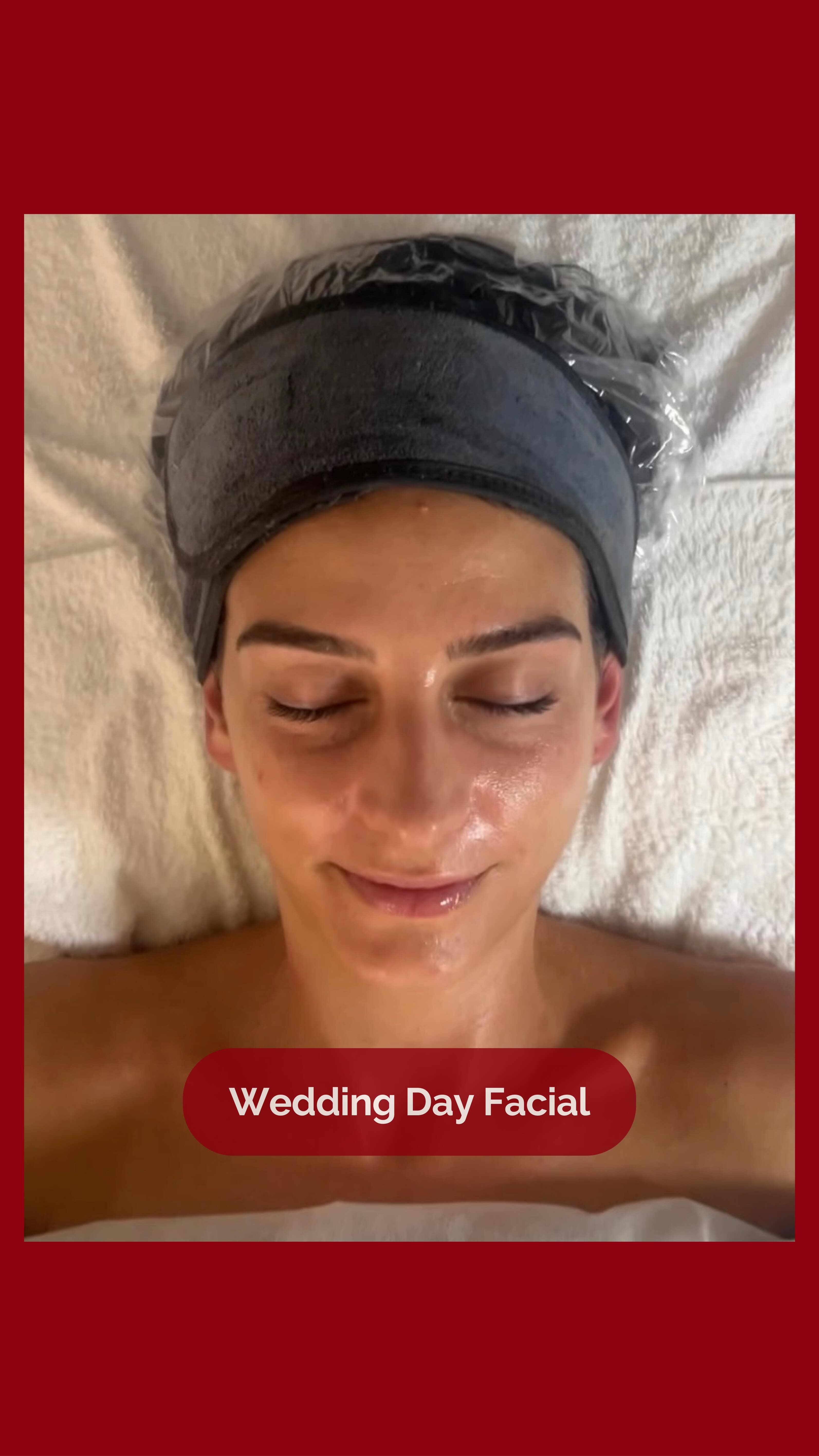Glowing skin, radiant bride ✨
Our client looked absolutely stunning on her wedding day, and we’re so happy she trusted Redwood to be part of her self-care journey leading up to it. 💍💆
📍 4141 Yonge St, #304, Toronto, ON M2P 2A6
📞 (416) 481-2888
📩 info@redwoodmedispa.com
#redwoodmedispa #weddingskin #bridalskincare #glowingskin #facialtreatment #torontomedispa #bridalbeauty #skinconfidence #skincare #skin #facial #wedding #beauty #wellness