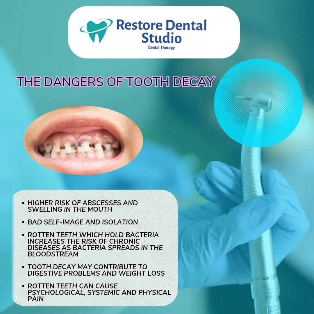 Time to restore your smile 🦷