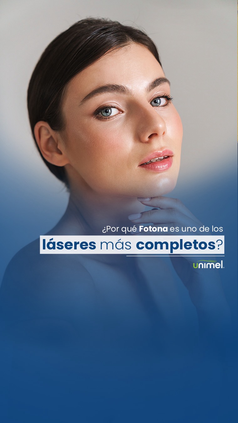 Fotona es uno de los láseres más versátiles en medicina estética: un solo equipo capaz de tratar melasma, rosácea, rejuvenecimiento, léntigos, cicatrices, textura, alopecias e incluso hongos en las uñas.
Cada longitud de onda trabaja una capa diferente de la piel, permitiendo personalizar el tratamiento según cada necesidad.
En Unimel lo usamos como una herramienta de precisión para lograr cambios visibles, seguros y progresivos. ✨
#FotonaLaser #TecnologíaEstética #PielSaludable #ResultadosReales #Unimel