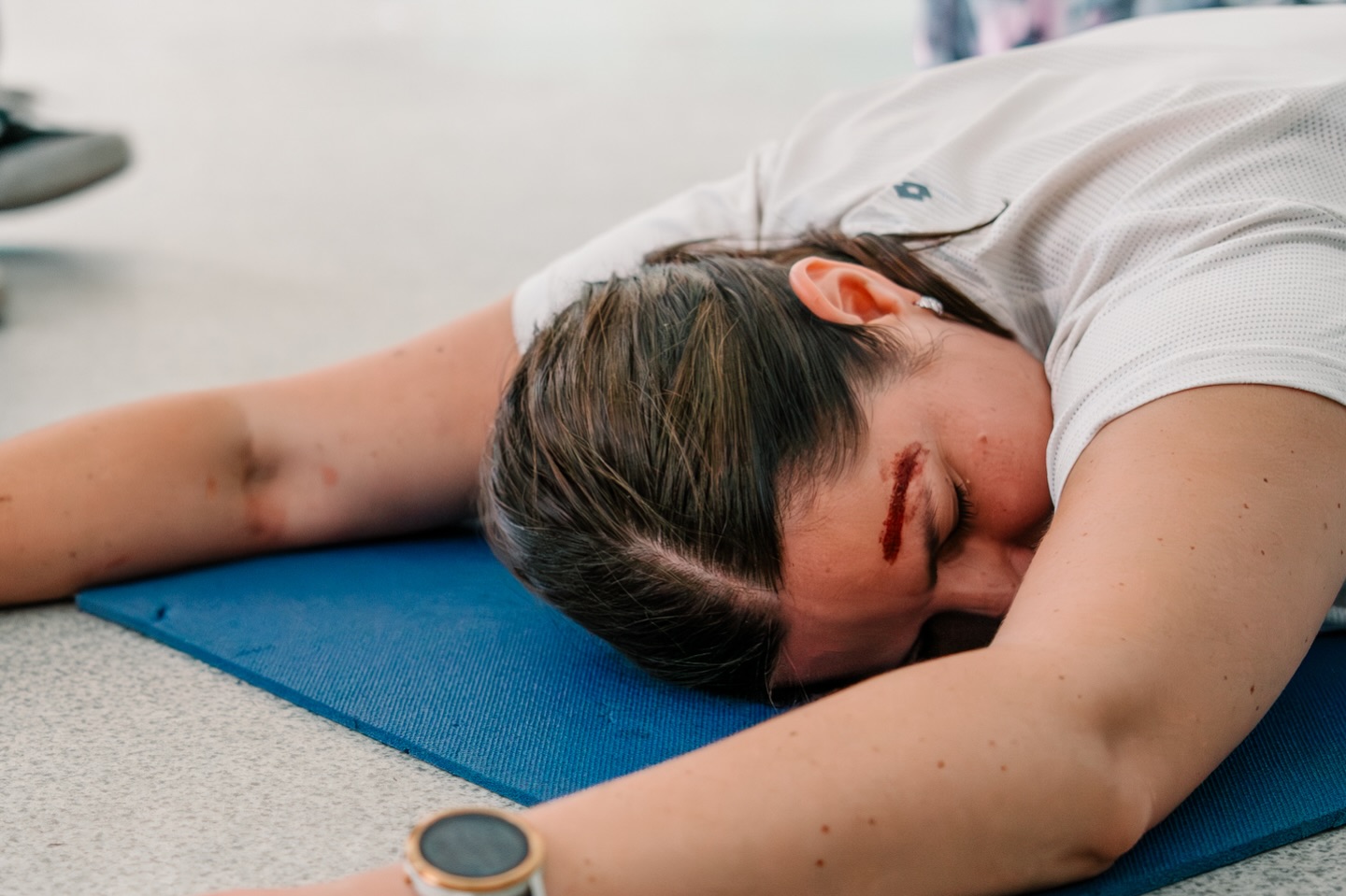 🧠ÚRAZY HLAVY: NEPODCEŇUJ TO!
Úrazy hlavy patří mezi nejzávažnější. U těžkých poranění jde často o minuty – nečekej a jednej.
❓ Jak vzniká úraz hlavy?
– úder do hlavy
– pád předmětu
– pád z kola / výšky
– dopravní nehody
🩸 Jak to poznám?
I bez viditelného krvácení může být situace vážná.
👉Sleduj zejména:
* nevolnost, zvracení
* bolest hlavy
* zmatenost
* poruchy vědomí až bezvědomí
* ztrátu paměti
* výtok krve z nosu/ uší
* „brýlový“ hematom
* nestejné zornice
🌀 Co je otřes mozku?
Určitě tě v souvislosti s úrazem hlavy napadne otřes mozku, kdy se mozek po silném nárazu „odrazí“ o lebku → otřese se.
👉Typické příznaky:
– krátké bezvědomí
– opakované dotazy / výpadek paměti
– nevolnost, zvracení
🆘 Jak poskytnout první pomoc?
1️⃣ Bezpečnost – dbej na svojí bezpečnost pak pomoz ostatním.
2️⃣ Poloha – člověka při vědomí dáme do polohy se zvýšenou horní polovinou těla, při bezvědomí jednáme dle běžného postupu.
3️⃣ Volání 155 – vždy při podezření na úraz hlavy!
4️⃣ Tepelný komfort – přikrýt, izolovat od země.
5️⃣ Krvácení – překrýt, pokud je čas.
Sleduj stav! Může se rychle zhoršit – i k zástavě dechu.
Chceš umět správně poskytovat první pomoc?👇
🎯 Teorie nestačí. Nauč se první pomoc prakticky a nanečisto — info o našich kurzech najdeš v bio! 🤍