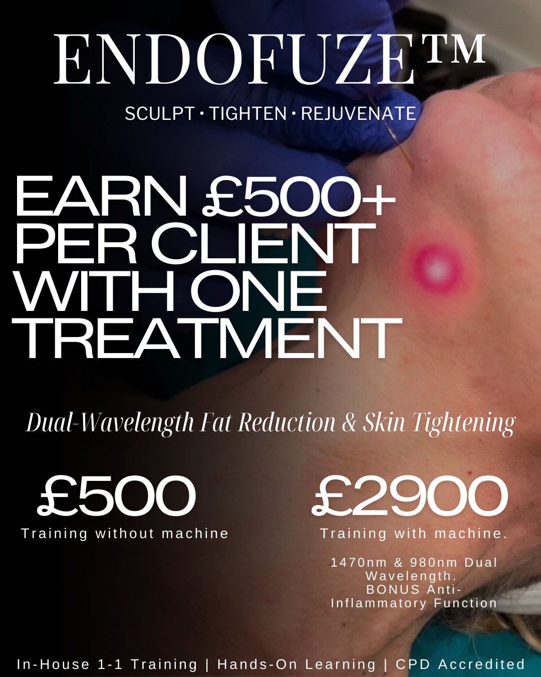 ✨ EndoFuze™ Training ✨
This is the treatment everyone’s asking for, and the one that actually delivers results clients are happy to pay for.
💥 Earn £500+ per client with a single treatment
💥 Dual-wavelength technology (1470nm & 980nm) for fat reduction + skin tightening
💥 One treatment. Visible change. High client satisfaction.
EndoFuze isn’t a “nice add-on” — it’s a high-ticket, in-demand service that slots perfectly into an existing aesthetics clinic and pays for itself quickly.
✔️ In-house, 1-1 training
✔️ Hands-on, real models
✔️ CPD accredited
✔️ Full protocols, settings & safety covered
✔️ Optional machine package available
Most practitioners don’t struggle because they lack clients —
they struggle because they’re offering low-return treatments.
This changes that.
Limited training spaces available (by design — we keep it exclusive).
If you’ve been waiting for the right time to level up your income and treatment portfolio… this is it.
📩 DM FUZED to secure your training
or WhatsApp 07865 763878 for full details.
EndoFuze™ — sculpt, tighten, rejuvenate.
