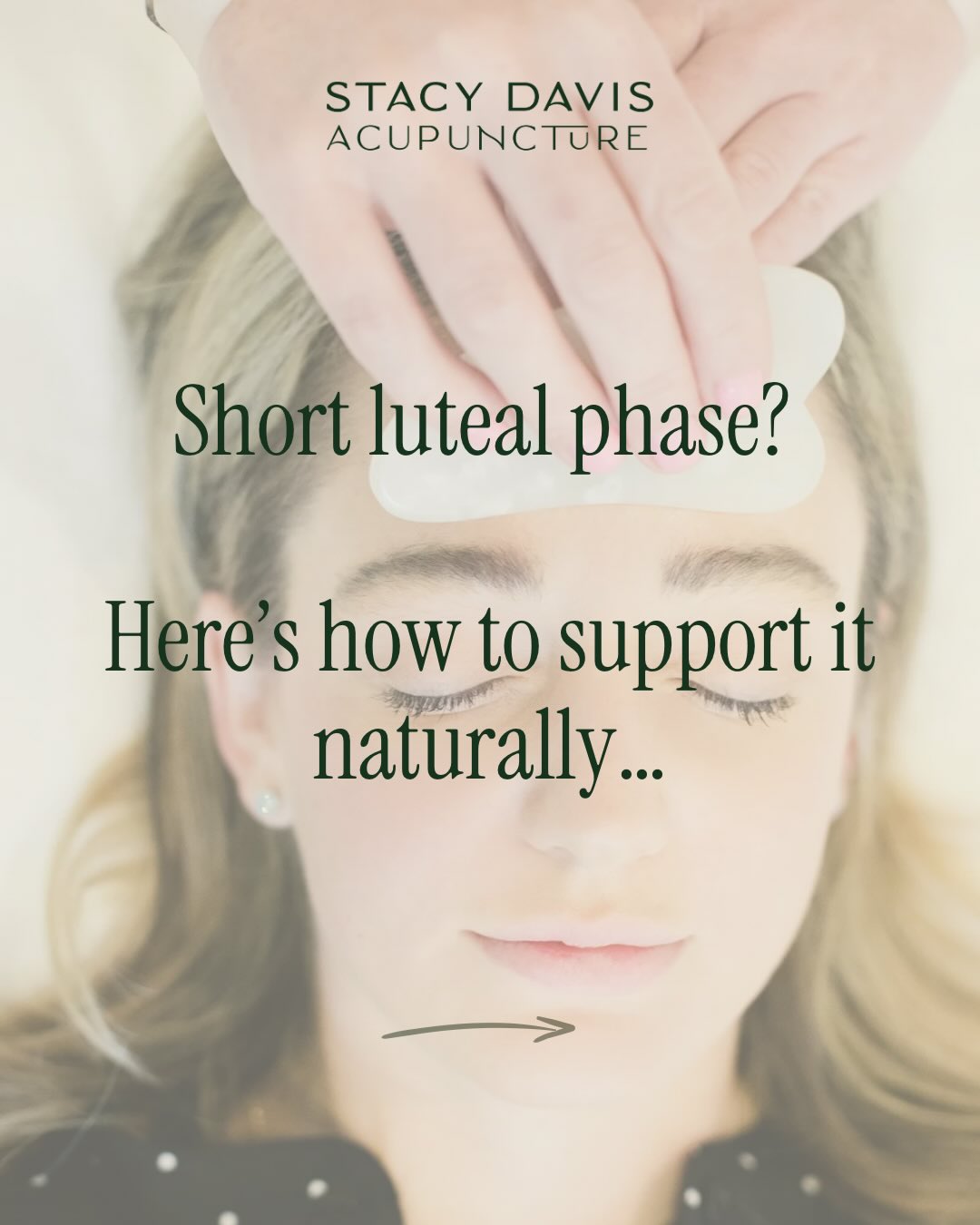 A supported luteal phase can make your whole cycle feel steadier.
These small shifts help your hormones settle into a rhythm that feels calmer and more consistent.
Comment Freebie10 and I will send you my free guide.
Sx
#lutealphase #cycleawareness #fertilitysupport #womenshormones #ttccommunity #acupuncture