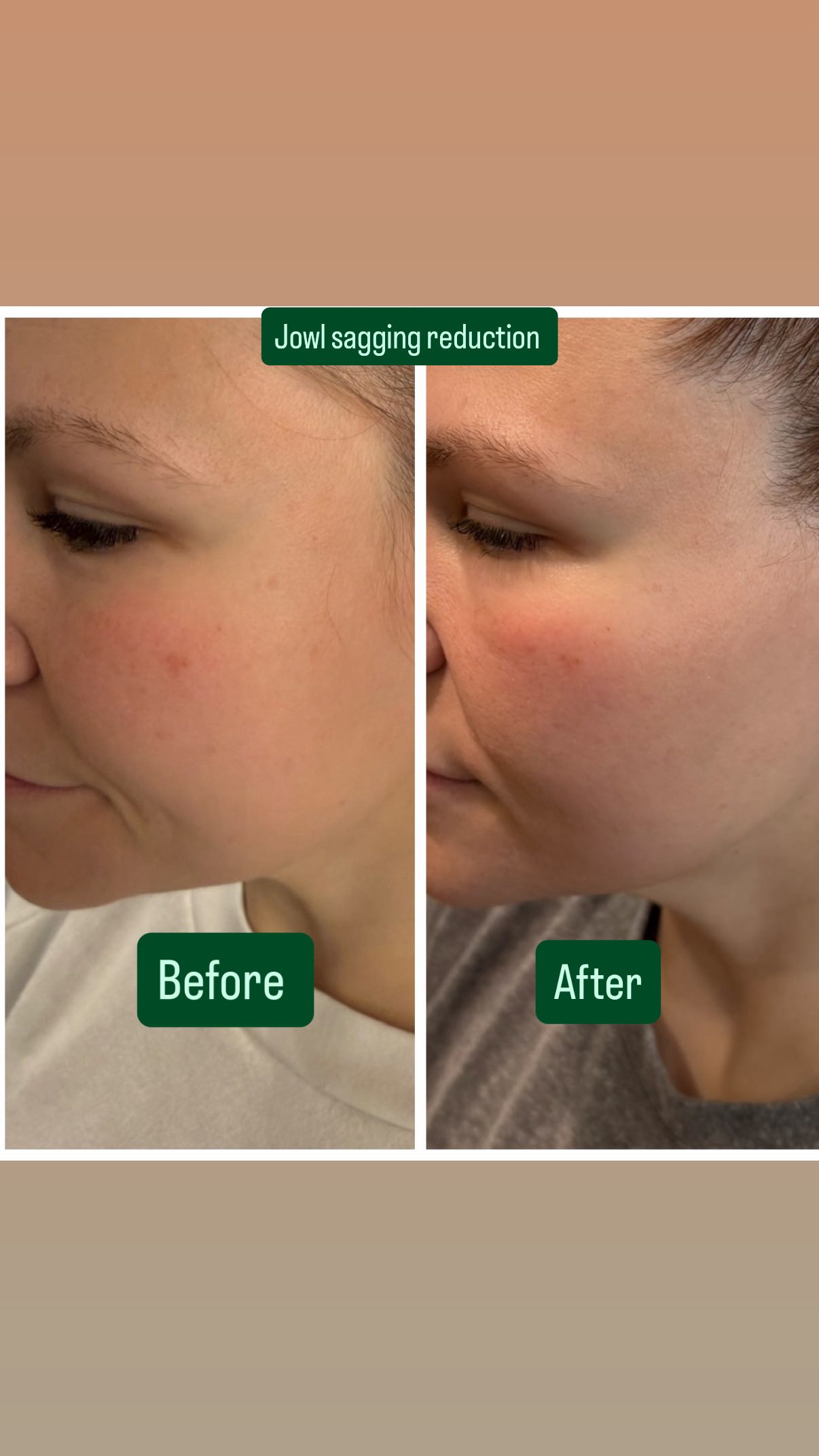 Beauty and skin care over 30 is important. We can help with that! #kemskin #skincare #lashes #waxing #brows