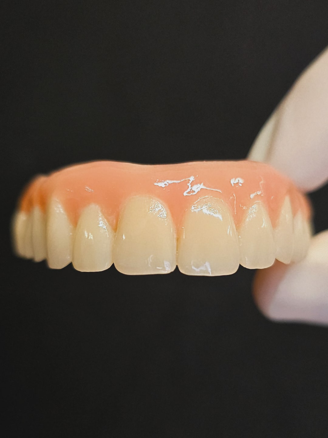 Leggi il caso di questa #protesidentale 👇🏻
🦷 Manufatto: Protesi totale com barra e contro barra su arcata superiore, realizzata in resina e composito, rinforzata con fibra di vetro per una durabilità massima.
👴🏻 Caso clinico: paziente di 80 anni che veniva da una situazione di protesi mobile con elementi in metallo e due impianti posizionati nell'arcata superiore. Situazione di discomfort masticatorio e funzionale.
🩹 Piano di cura: posizionamento di ulteriori 2 impianti in chirurgia computer guidata in situazione di carenza ossea, senza incisioni gengivali, senza dispersione di sangue e senza l'applicazione di punti di sutura, per un comfort operatorio massimizzato.
🎯 Risultato: ripristinata una corretta masticazione oltre ad un'adeguata componente estetica con una protesi stabile e facile da pulire nell'igiene quotidiana.
👨🏻⚕️ Dottore: Claudio Marinelli
Dental Aesthetica
✨️ Odontoiatria e Medicina Estetica
📍 viale della Grande Muraglia 256, Roma EUR-Torrino
📱 375 88 47 069
#dentista #roma #prevenzione #salute #riabilitazione