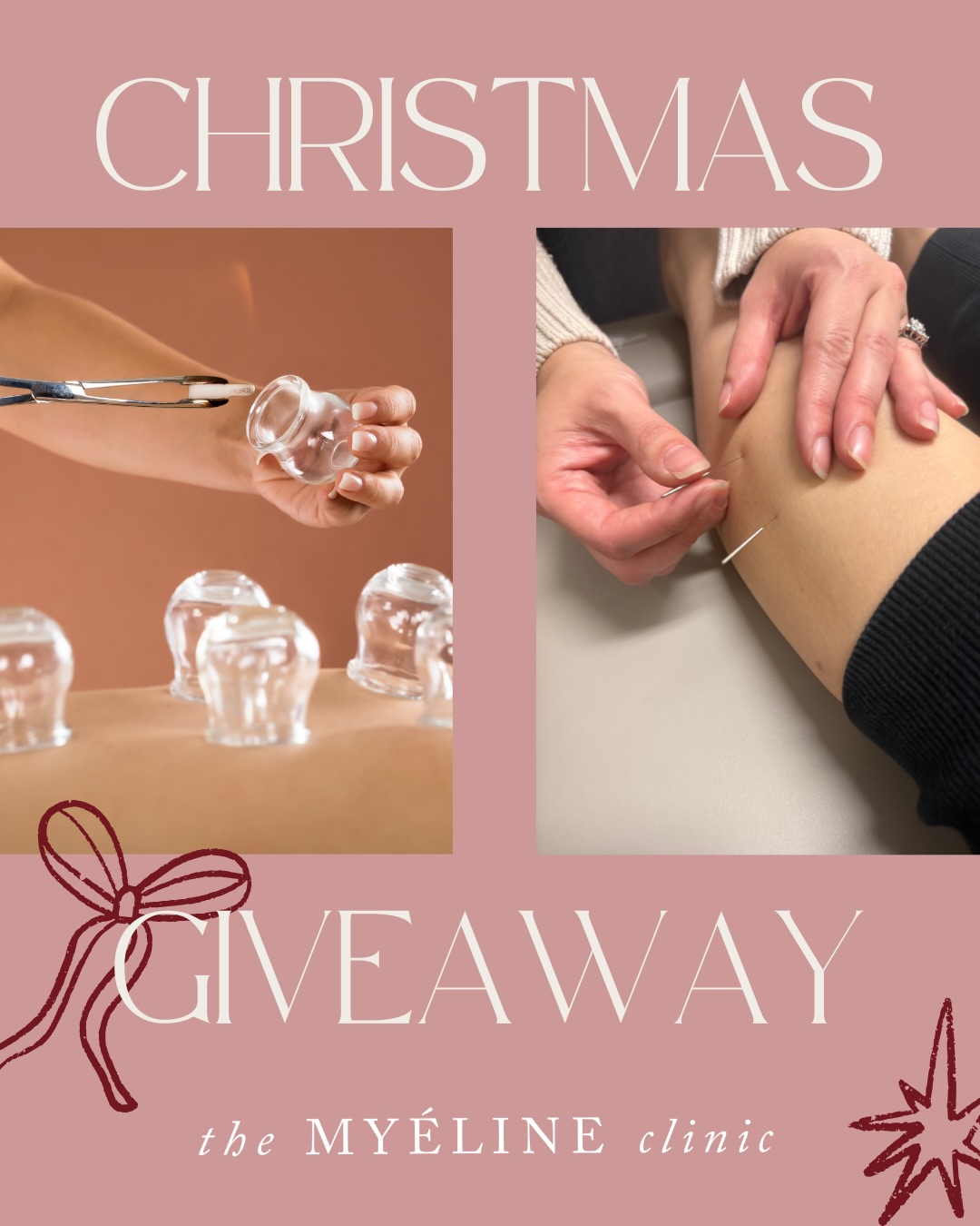 Myéline Christmas Giveaway 🎄💕
We’re giving one lucky person the chance to win 1x myofascial cupping session AND 1x dry needling session, package valued over $120.
How to enter
1. Like this post
2. Follow our page
3. Tag you friend (each tag is an entry)
BONUS ENTRY: Share this post to your story
That’s it.
The winner will be announced Christmas Eve at 5:00pm AEST.
Good luck, and Merry Christmas from our team.
Yours in health, The Myéline clinic xx