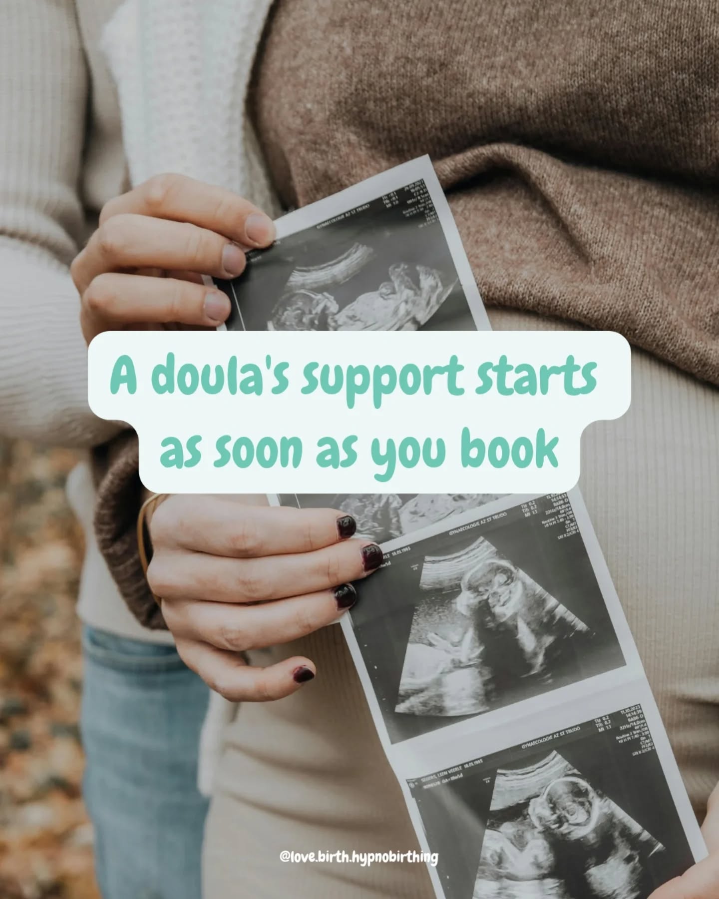Doula support doesn’t start when you go into labour, it starts the moment you book. Whether that's an in person or virtual package!
From early pregnancy you're supported so you can feel calm, informed, and confident all the way through 🤰🏼
What you'll be getting:
• Continuous emotional support from day one
• Evidence-based information to help you make informed choices
• Space to explore your birth preferences without pressure
• Tools for reducing fear and building confidence
• Support navigating appointments and birth options
• A trusting relationship built before labour begins for both you and your birth partner
• Feeling less alone and more empowered throughout pregnancy
If you've just found out you're having a baby in 2026, or maybe you've just had your 12 week scan, get in touch to book a free discovery call/meeting to find out more 🥰
#doulastaffordshire #DoulaSupport #virtualdoula #positivebirth #empoweredbirth #birthpreparation #hypnobirthing #12weekspregnant