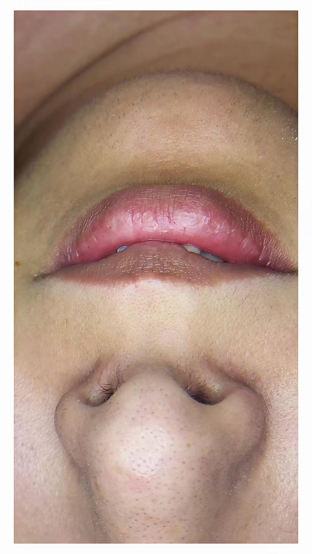 ¿Puntos negros, grasita y textura rara en tu piel? 😶🌫️
Con nuestra limpieza facial retiramos impurezas y devolvemos ese brillo sano que tanto te gusta. ✨
📲 Mayores informes o reserva al 4461484980
#PielLimpia #DinuxSPA #FacialProfundo #cuidadodelapiel