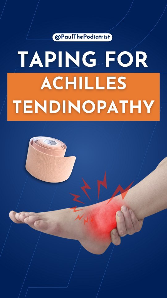 If you’ve got Achilles tendon pain, this taping technique can really help 🎯
Taping gives your Achilles a little extra support so it can calm down while you move. It reduces load through the tendon, helps with that morning stiffness, and makes walking and training feel a bit easier 👣
It’s quick, simple and something you can do at home in under one minute. Perfect for flare ups, busy days or when you need a bit of extra stability while it heals 💪
Watch the steps in the video and give it a go.
#achillestendon #achillespain #achillesinjury #achillestendinopathy #tapingtechnique #paulthepodiatrist #footpainrelief #podiatrytips #sgpodiatrist #singaporepodiatrist #runninginjury #runnersofsg #injuryprevention #foothealthtips #anklepain #calfstrain #sportsrehab #physiotips #tendontaping #heelpainhelp