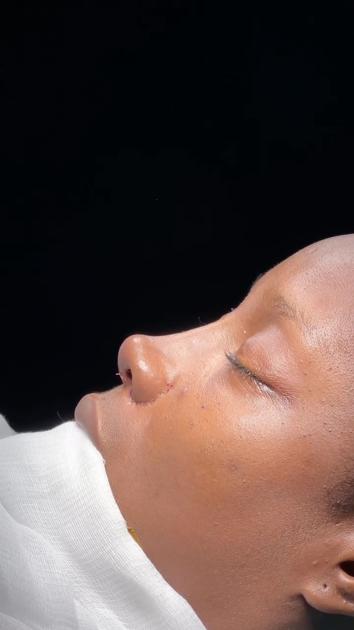 reduction 💪
no rib ⭐️