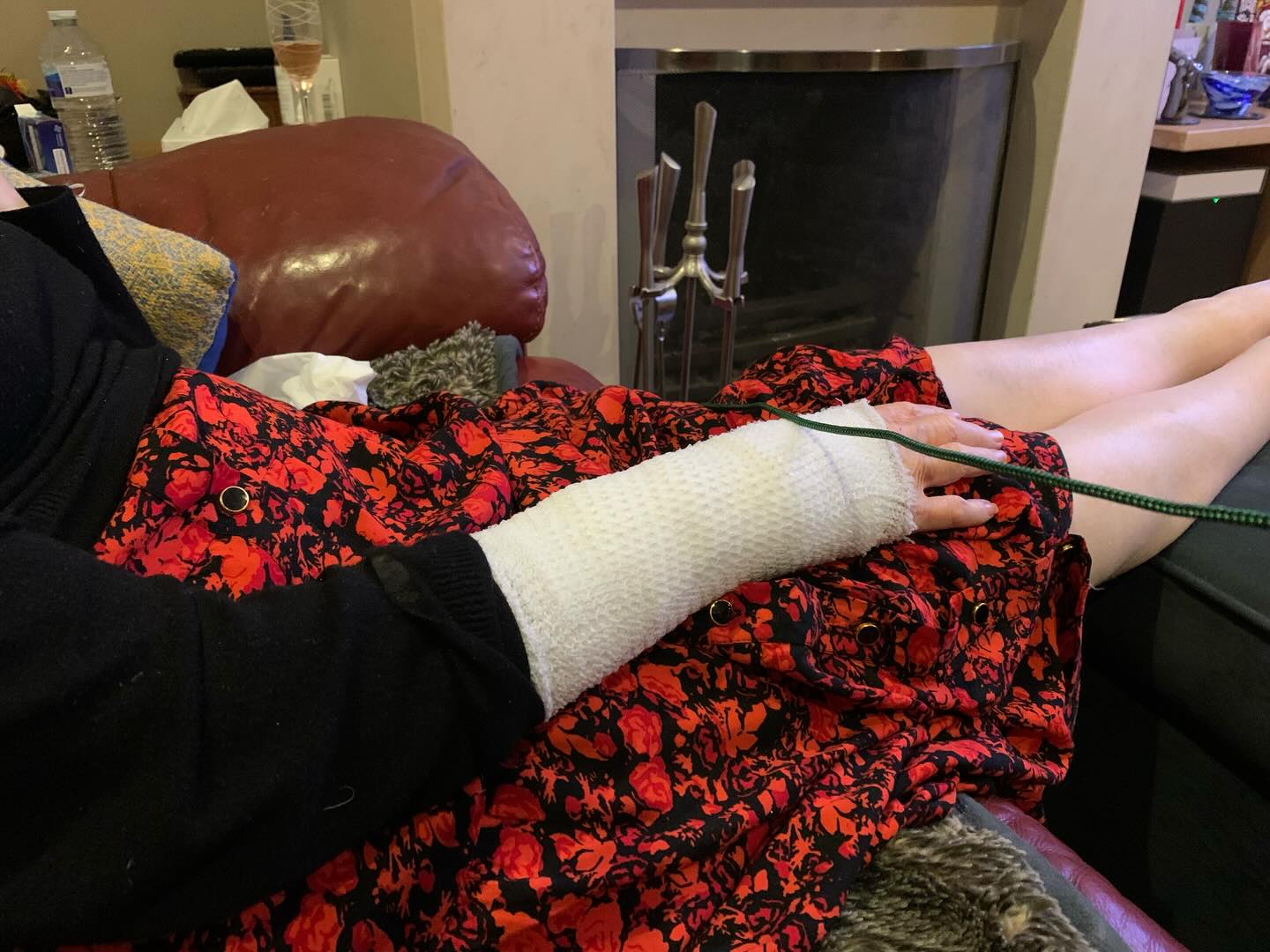 Breaking news: I attempted to retrieve the Christmas decorations. The loft steps fell out with my right arm. After a long A&E visit and some impressive medical arts & crafts, I’m home — but the decorations are staying put 🥴