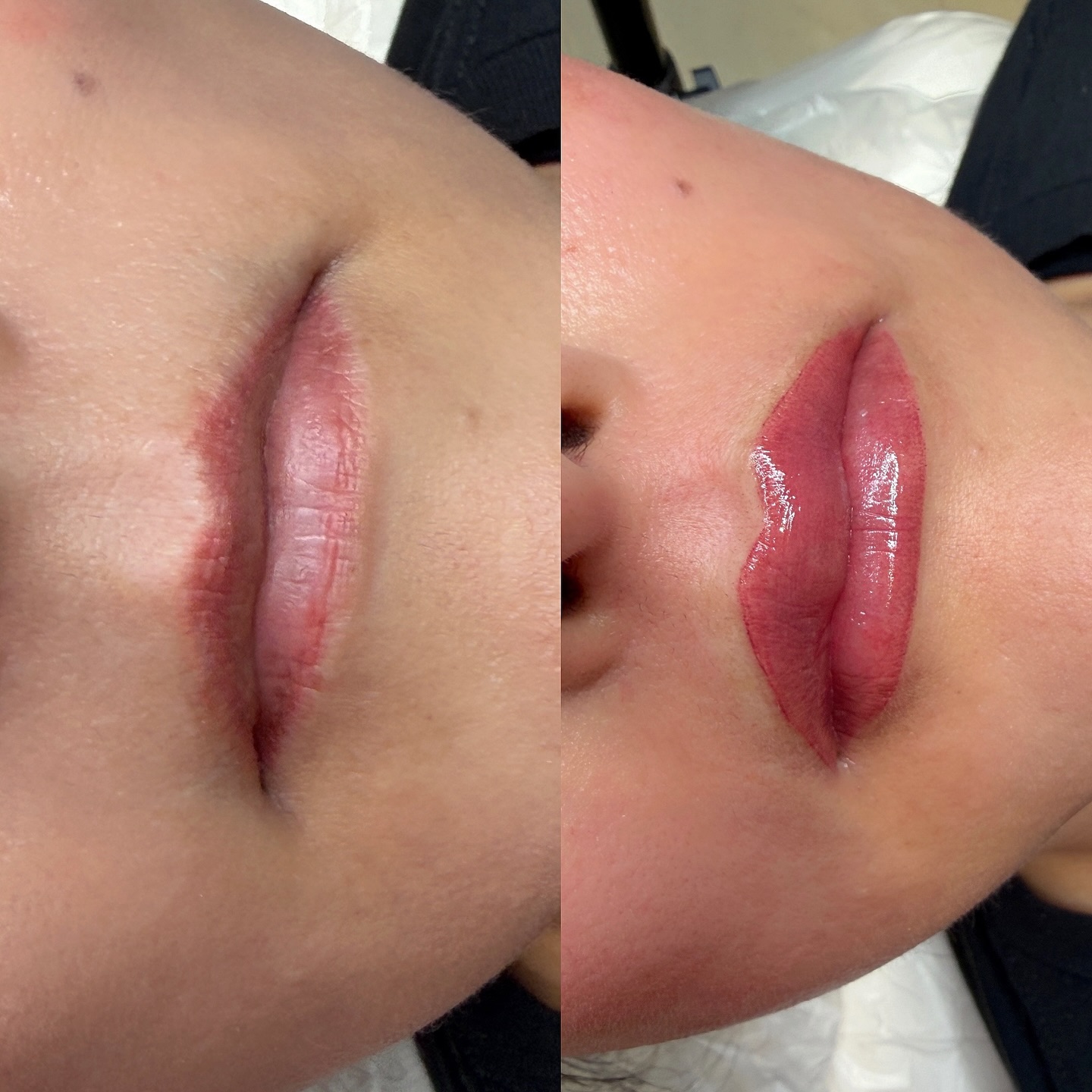 5 year old lip blush done elsewhere vs. new & fresh ❤️🔥
.
.
Lip Blush
• Lips heal soft and natural, 2-3 shades lighter.
• $550 (includes touchup in 6-8weeks).
• +50 for Dark Lip Neutralization
• $100 deposit required to make an appointment
• If you’ve had previous work done by another artist please send a clear picture prior to scheduling.
• Appointment duration is approximately 2.5-3 hours.
• Topical anesthetic applied.
• Please read cancellation, late, and no show policy.
• Link in bio to schedule your appointment!
.
.
#PowderBrows
#OmbreBrows
#PermanentMakeup
#BrowShading
#CosmeticTattoo
PowderBrowTechnique
BrowArtistry
SoftPowderBrows
EyebrowTattoo
PowderBrowSpecialist
Microblading
SemiPermanentMakeup
BrowMicroblading
EyebrowDesign
PerfectBrows
BrowTransformation
BeautyTips
BeautyHacks
NaturalBeauty
BeautyInspiration
LocalBusiness
Covinabusiness
downtowncovinabusiness
SupportLocal
CommunityBusiness