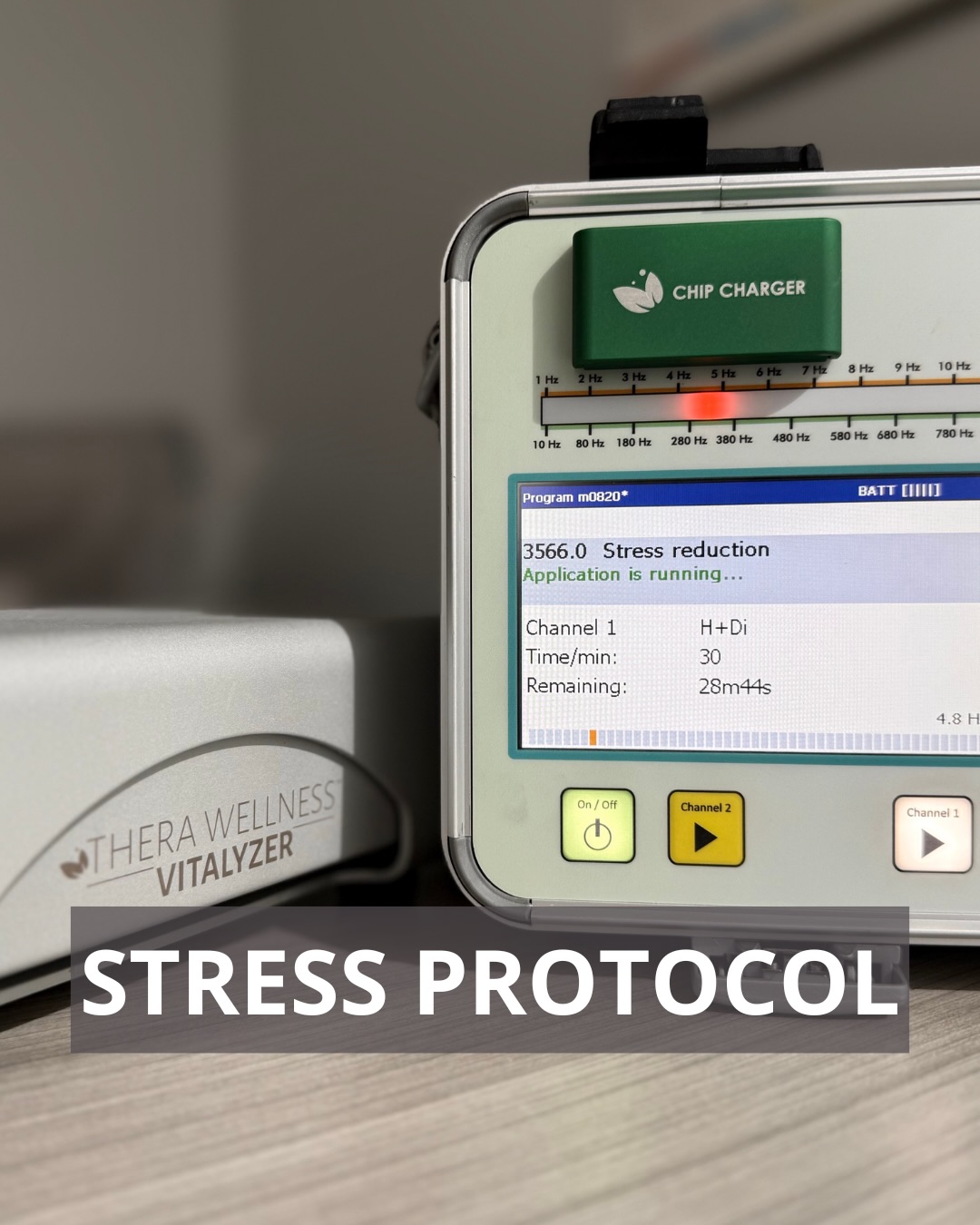 Poor sleep. Constant fatigue. Brain fog. Emotional swings.
These aren’t personality traits, they’re signs of stress.
Our holistic stress protocols are designed to help the system return to natural balance - calmly, deeply, and effectively.
#holisticmiami #biofieldtherapy #miamihealth #miamirecovery #Miamiwellness