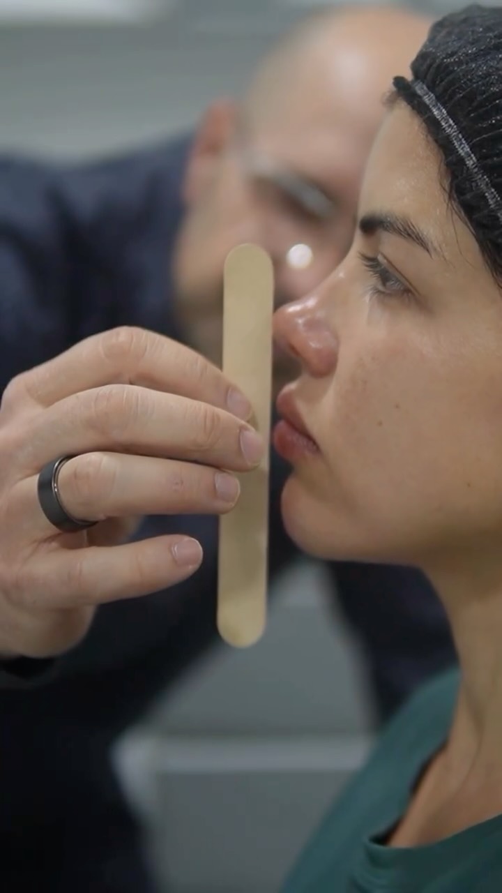 La belleza natural comienza con criterio médico.
Con una evaluación adecuada y manos expertas, los tratamientos respetan la anatomía, el movimiento y la esencia de cada paciente.
Porque en medicina estética, la experiencia marca la diferencia.
#MedicinaEstética #ExperienciaMédica #BellezaNatural #ResultadosReales